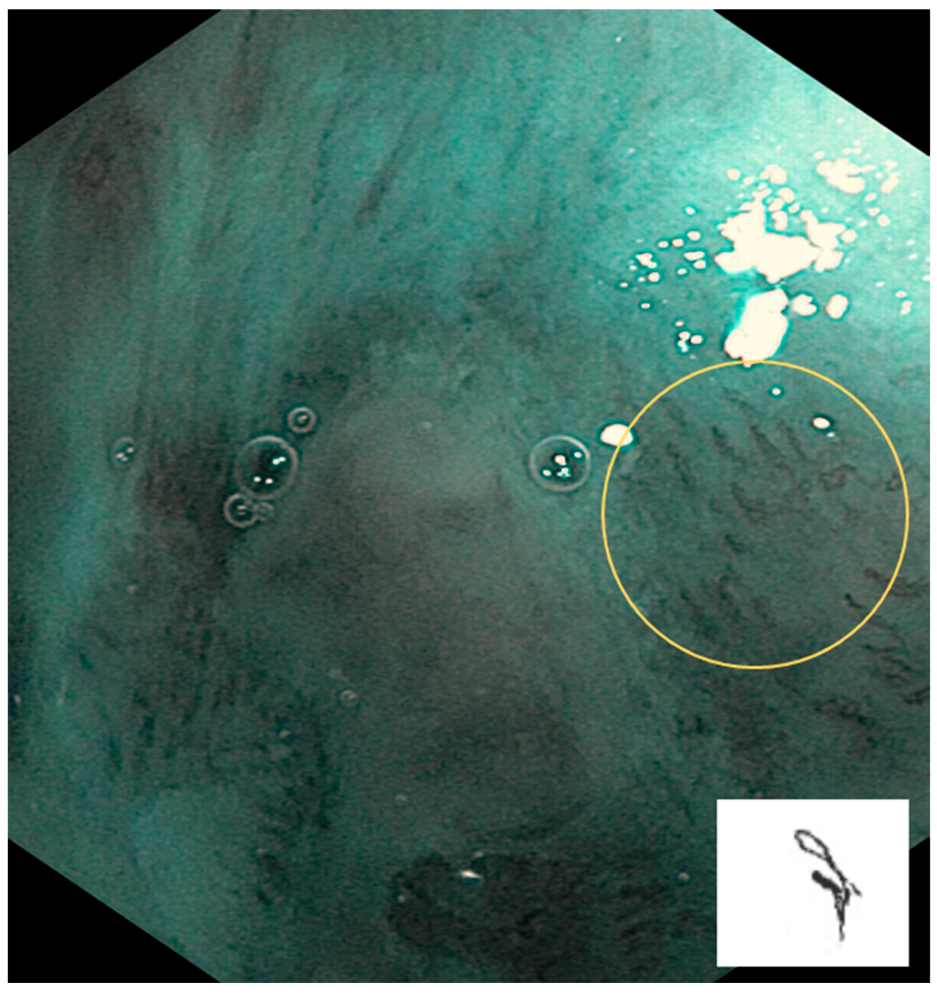 Cancers 17 00021 g003 Cancers 17 00021 g003