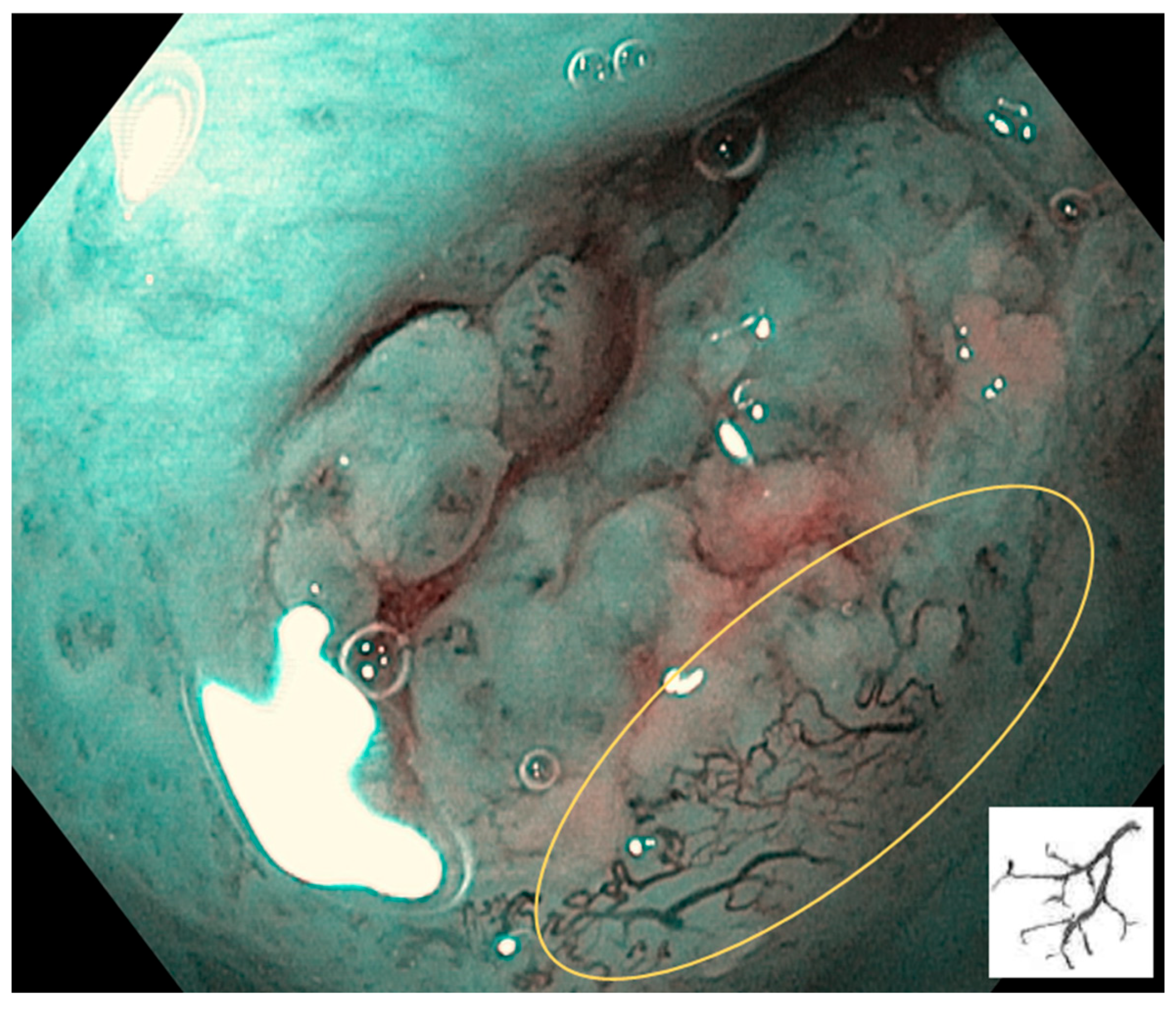 Cancers 17 00021 g005 Cancers 17 00021 g005