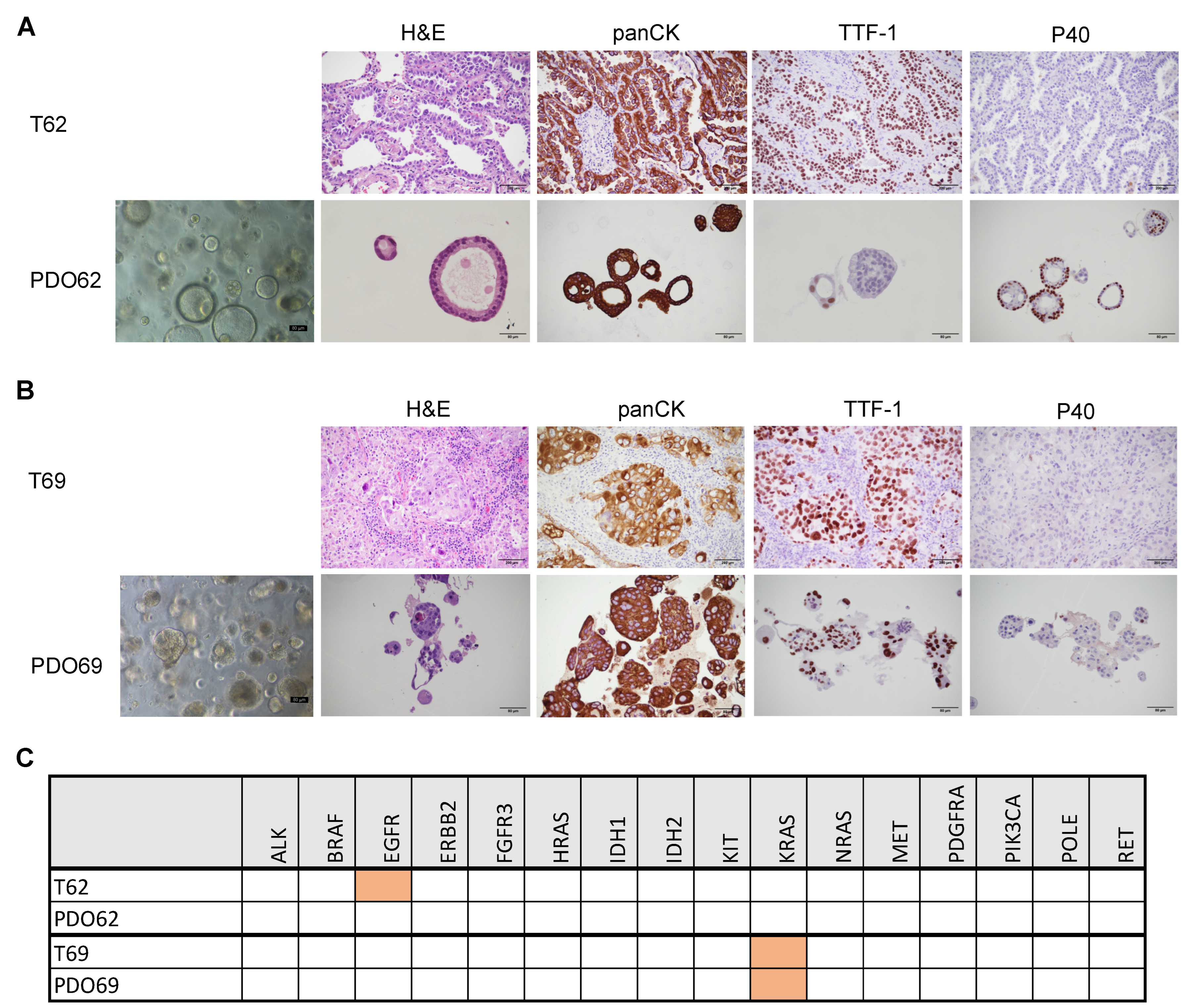 Cancers 17 00027 g004