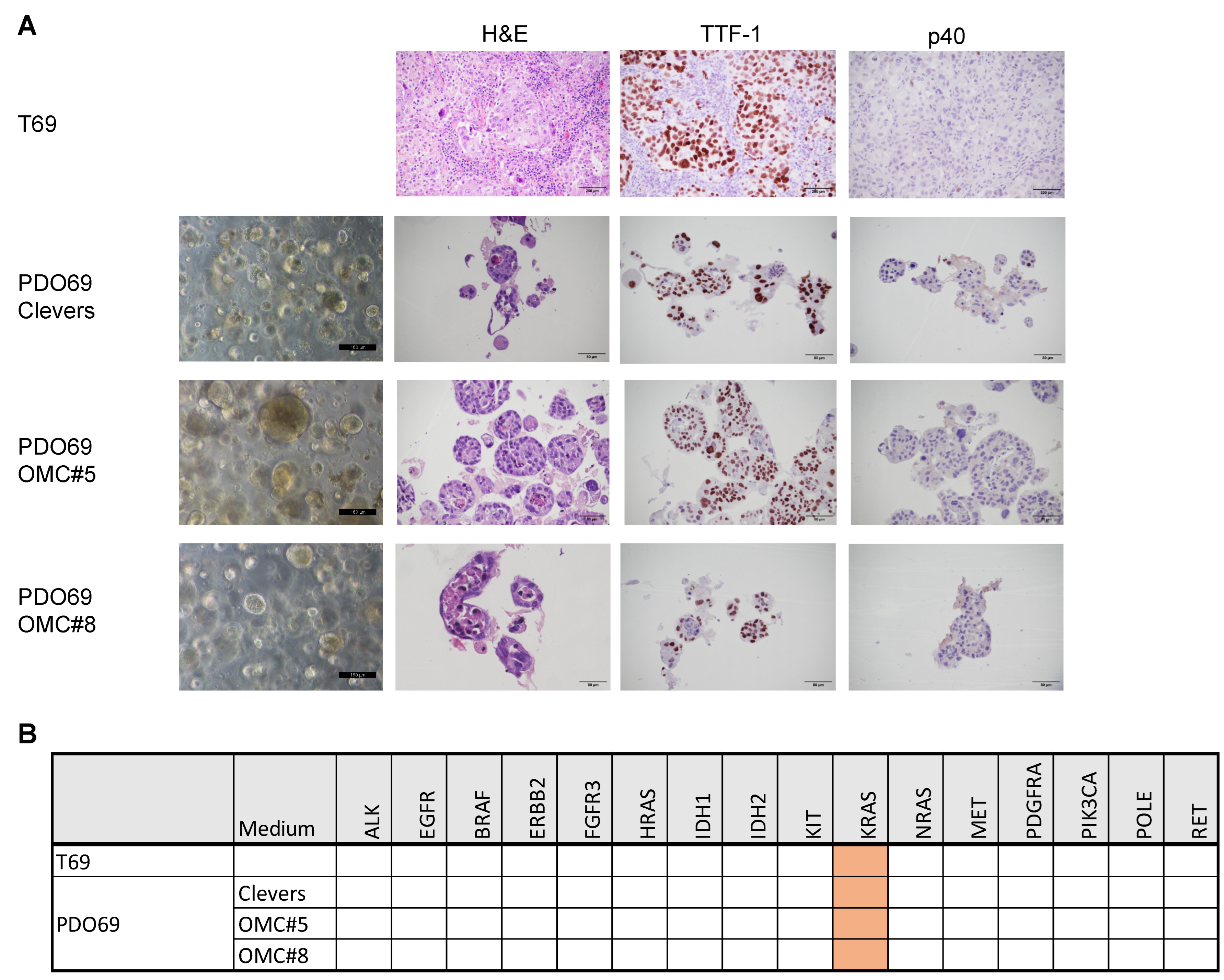 Cancers 17 00027 g006