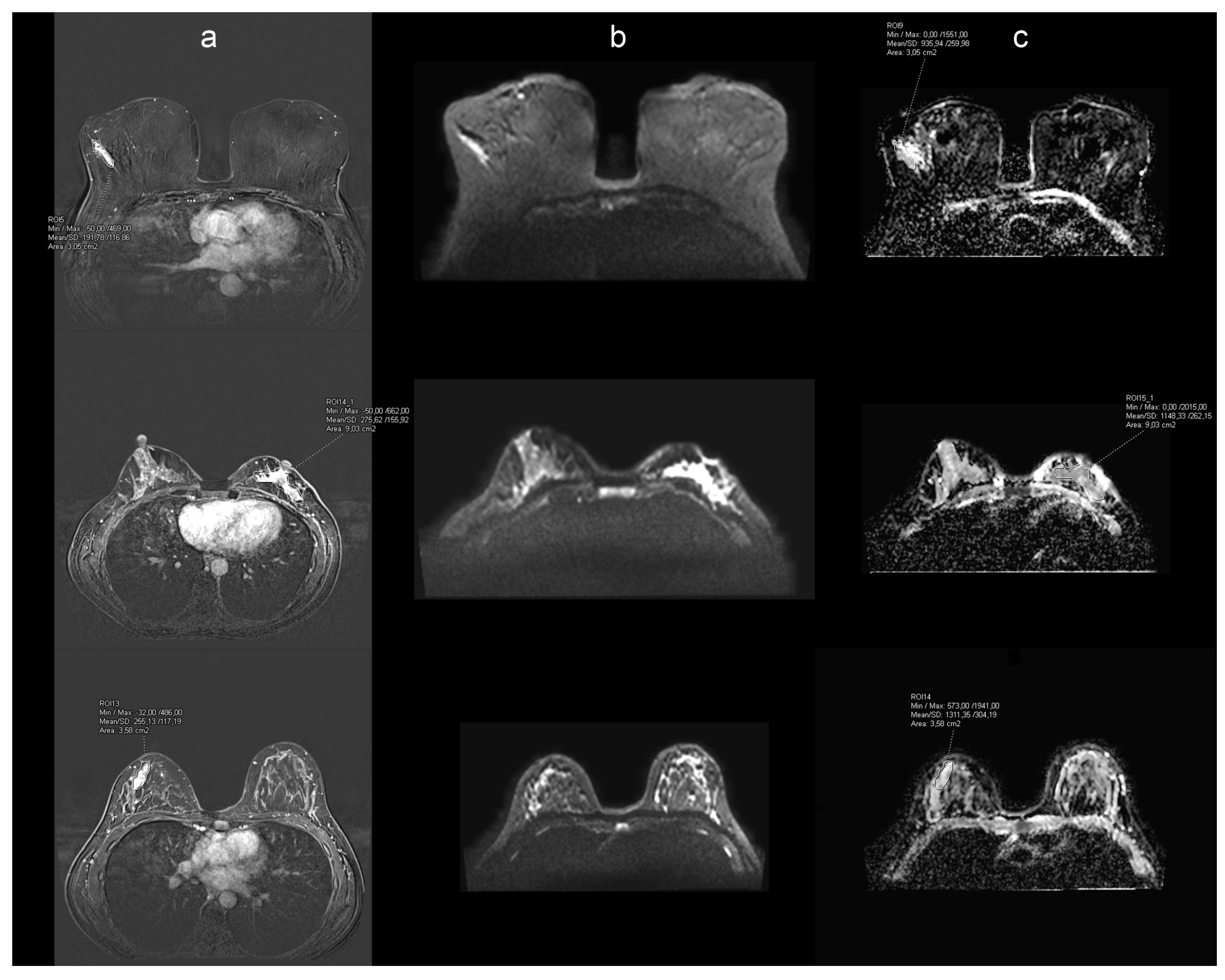 Cancers 17 00031 g002 Cancers 17 00031 g002