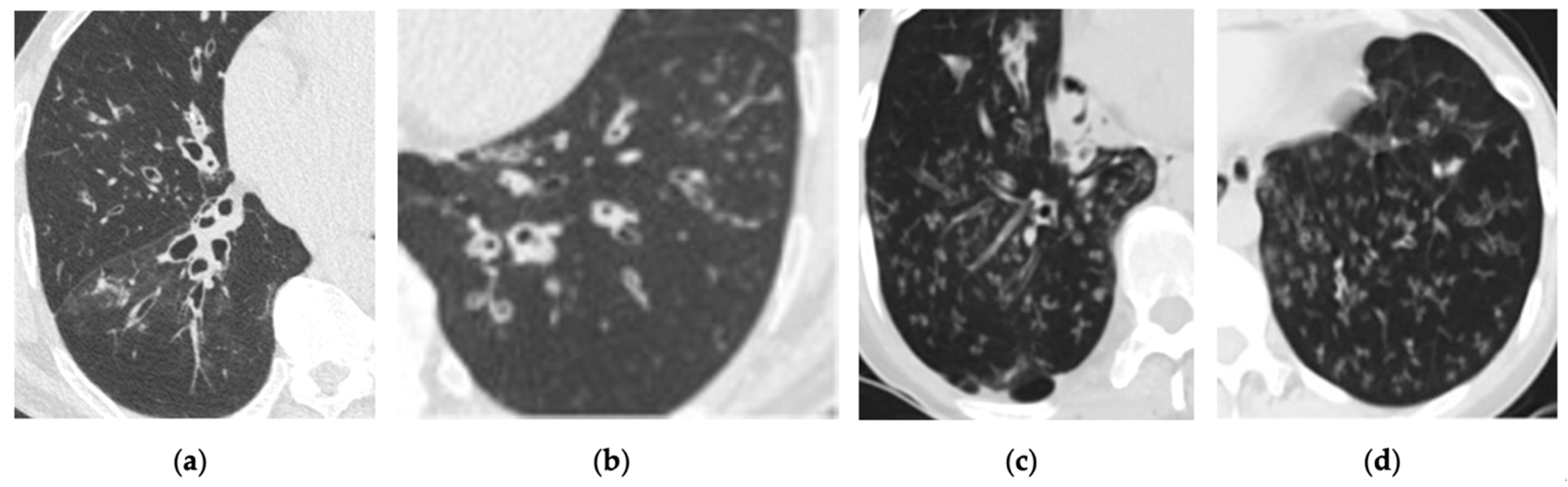 Cancers 17 00041 g004