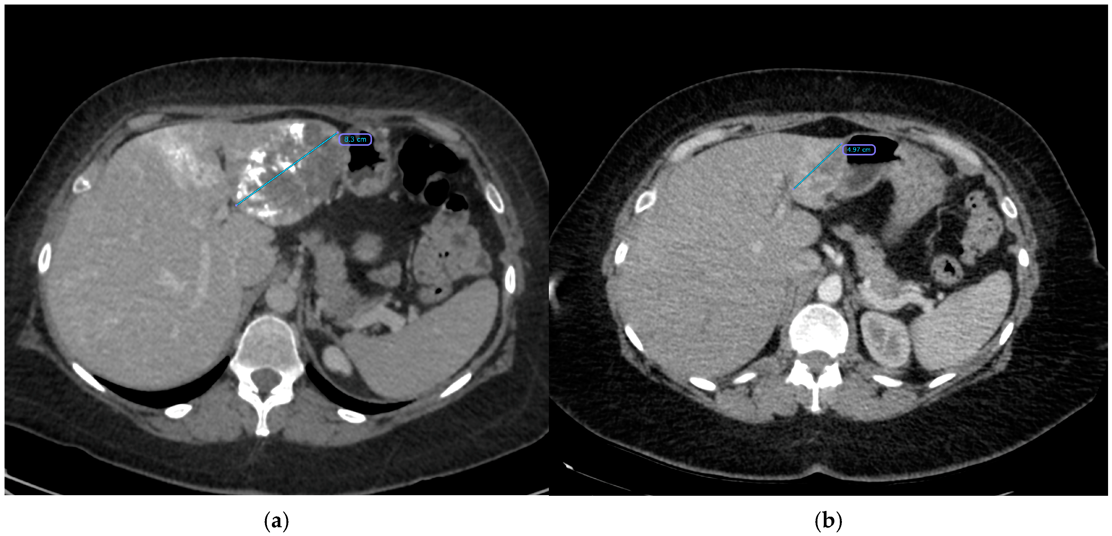 Cancers 17 00042 g004 Cancers 17 00042 g004