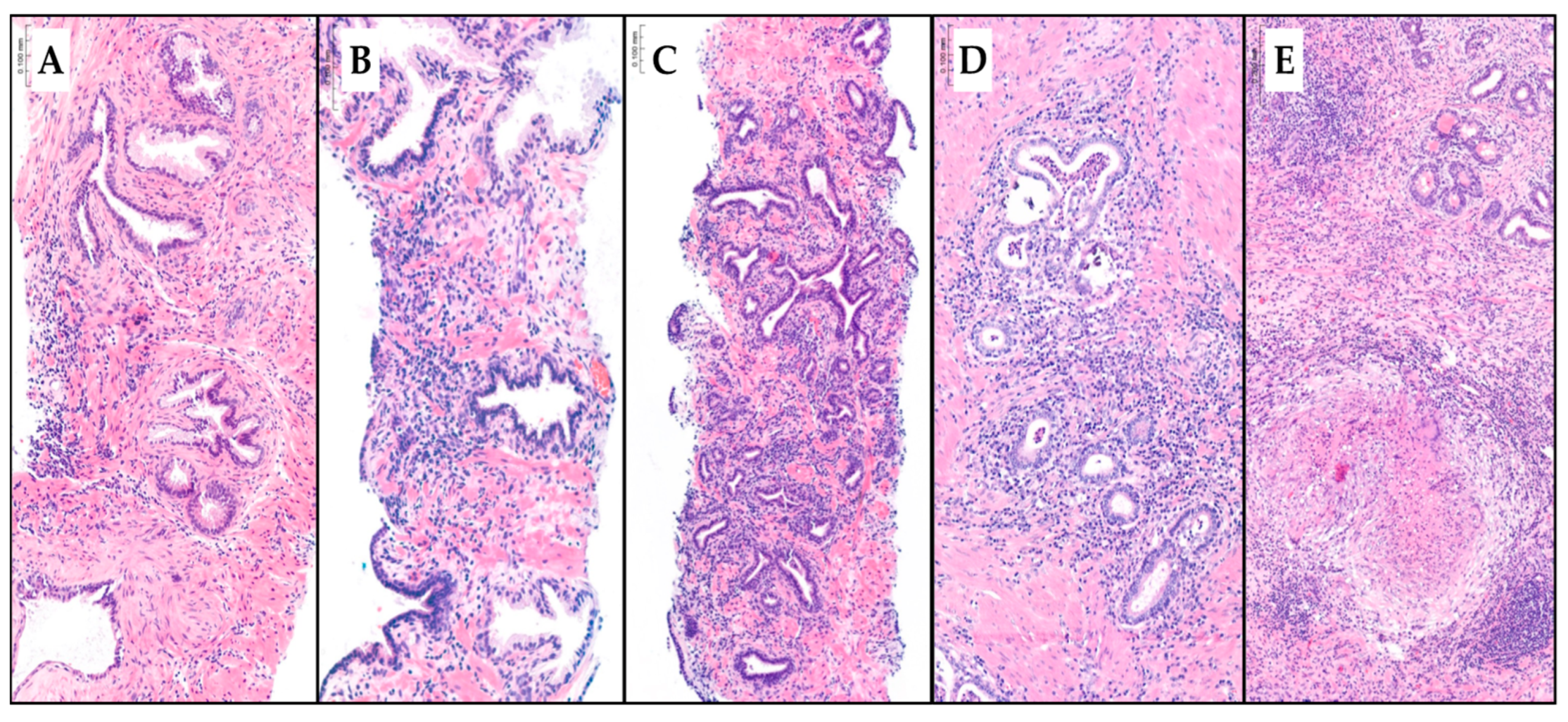 Cancers 17 00053 g001 Cancers 17 00053 g001