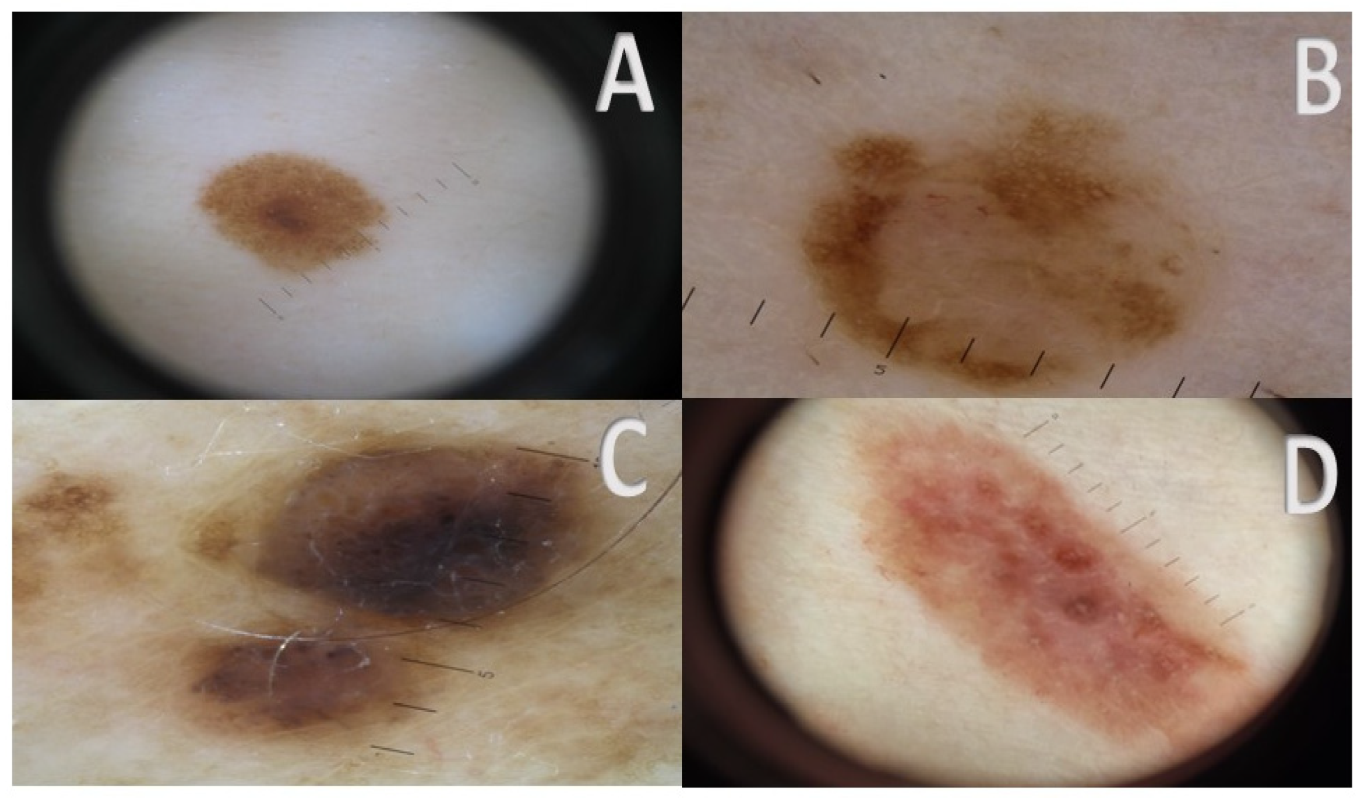 Cancers 17 00065 g001