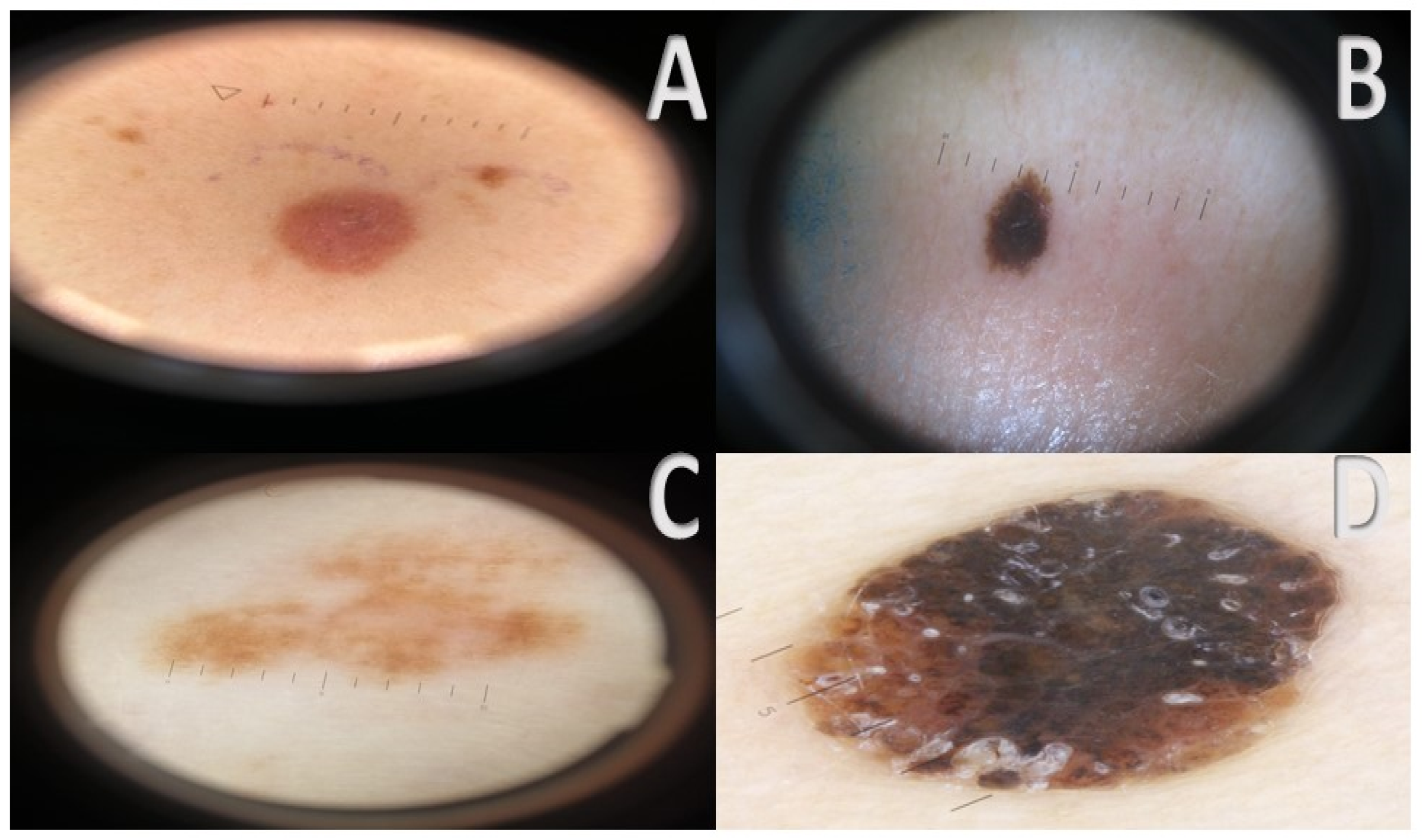 Cancers 17 00065 g002