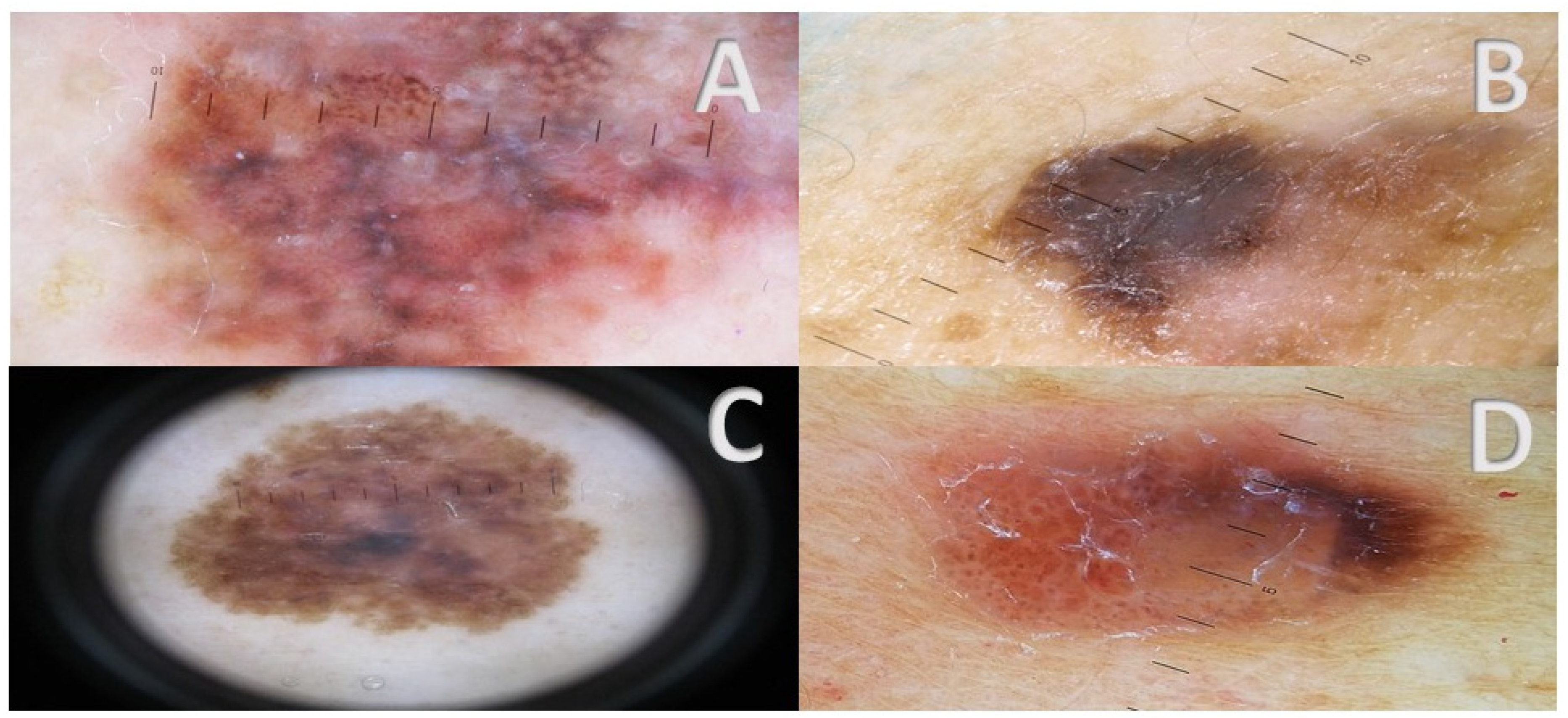 Cancers 17 00065 g003