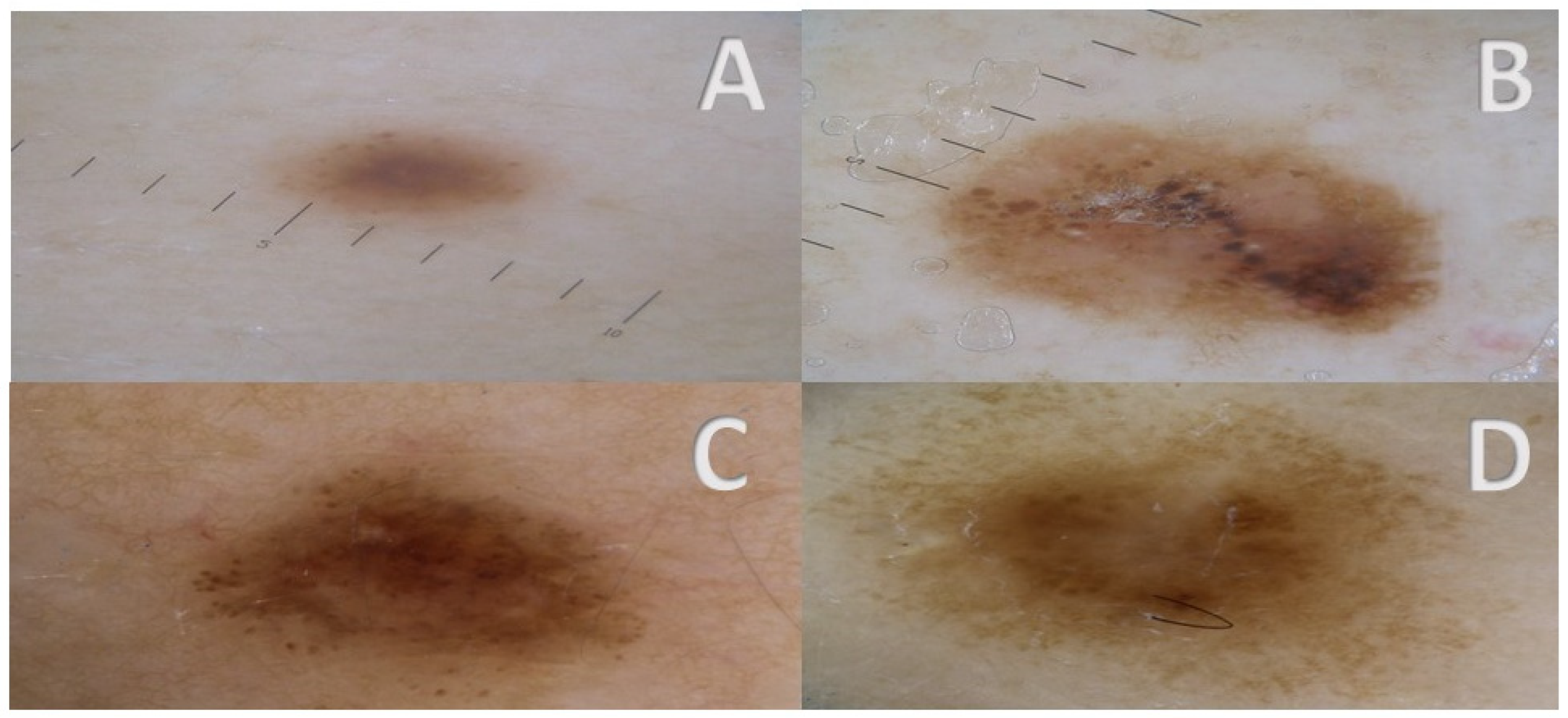 Cancers 17 00065 g004