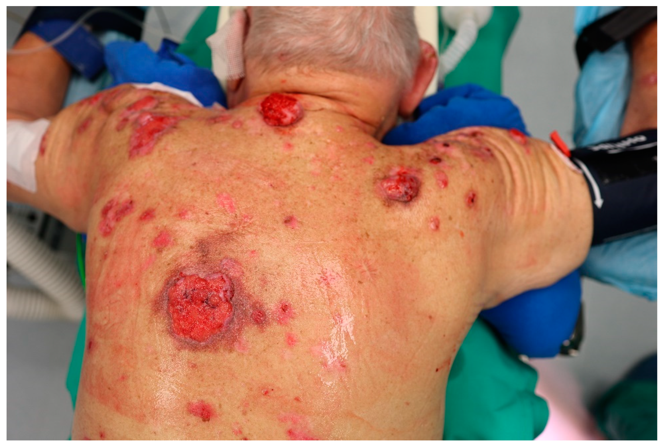 Cancers 17 00068 g002