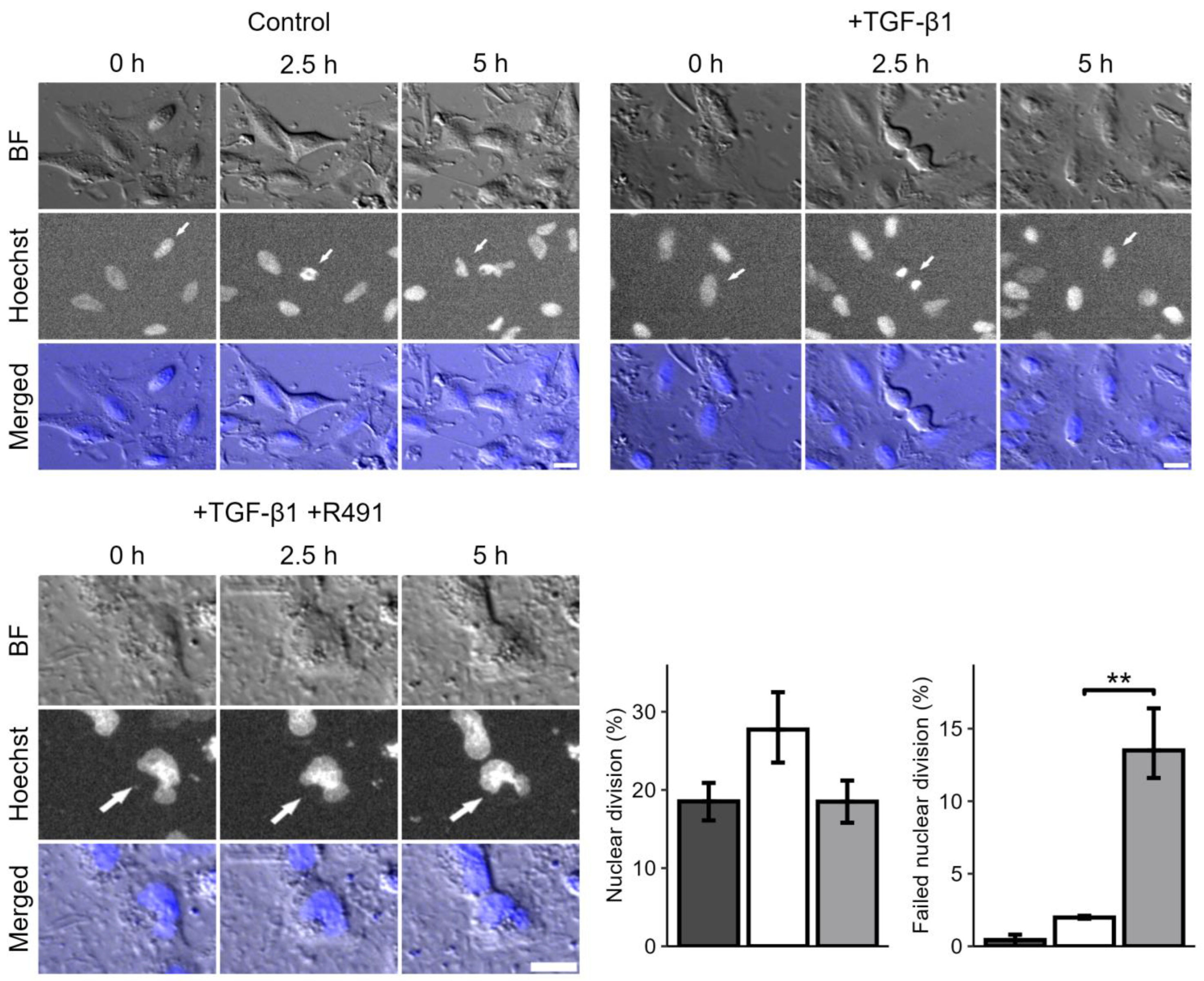 Cancers 17 00081 g003
