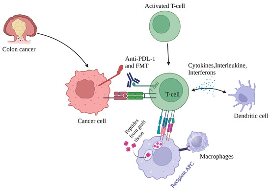 Effect of Gut Dysbiosis on Onset of GI Cancers