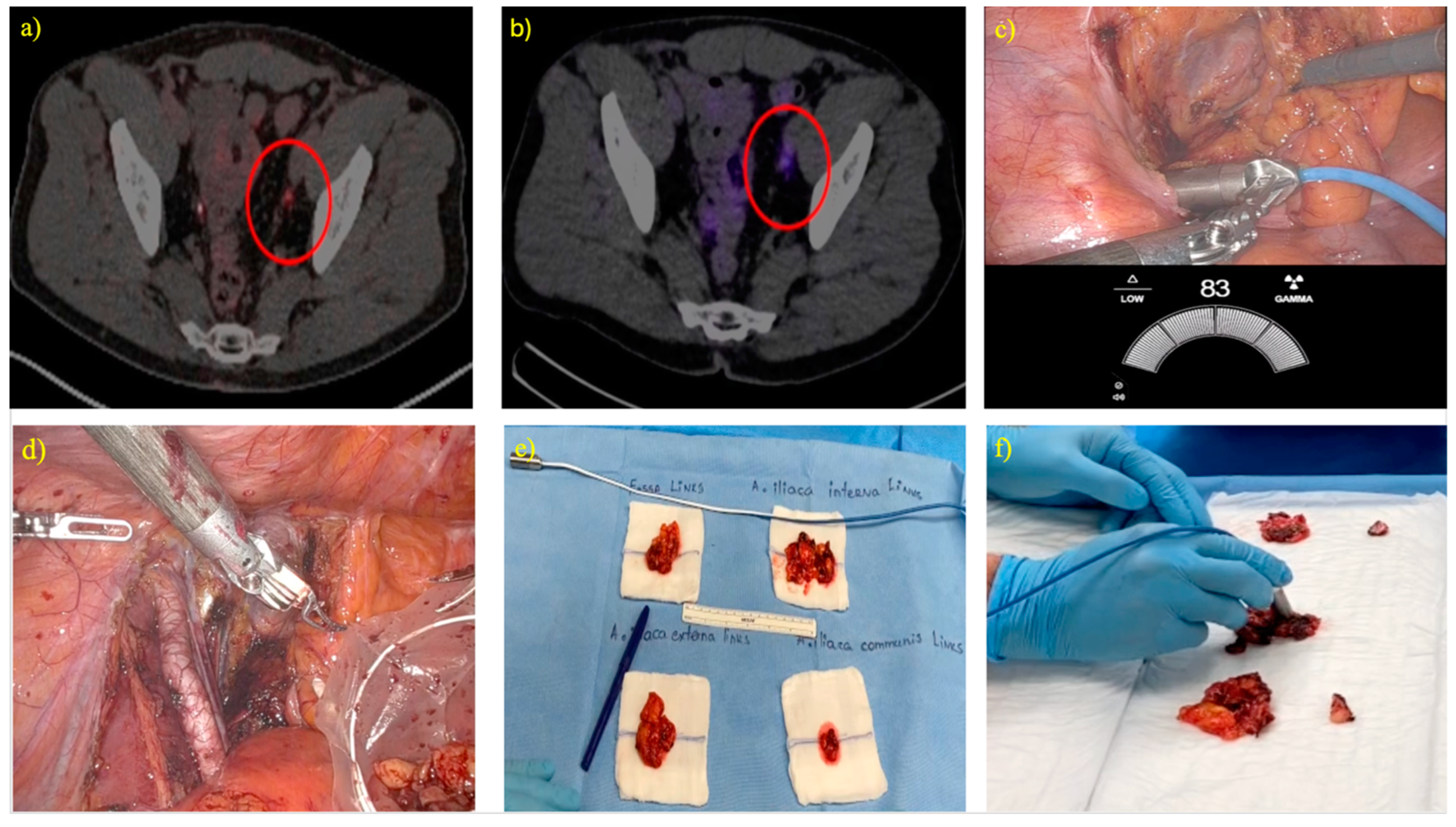 Cancers 17 00093 g001