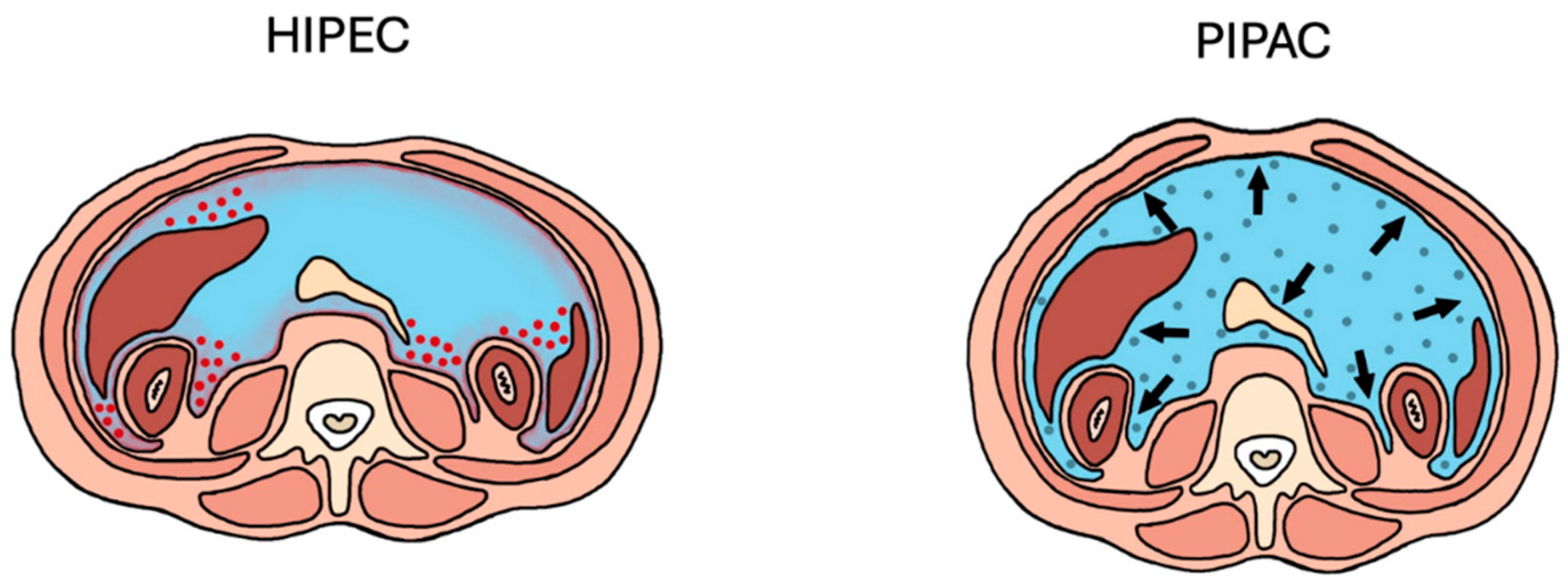 Cancers 17 00100 g002
