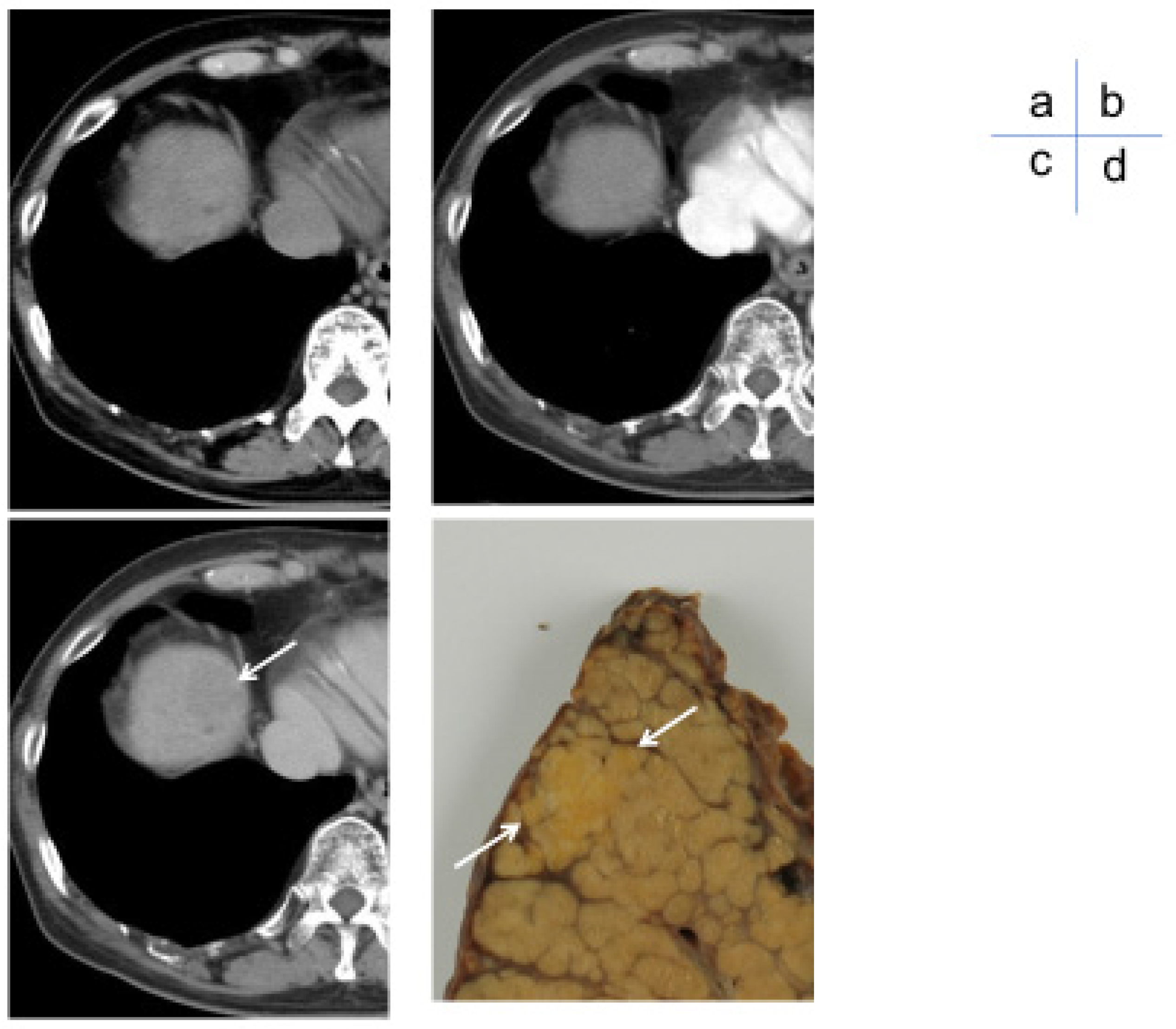 Cancers 17 00101 g002