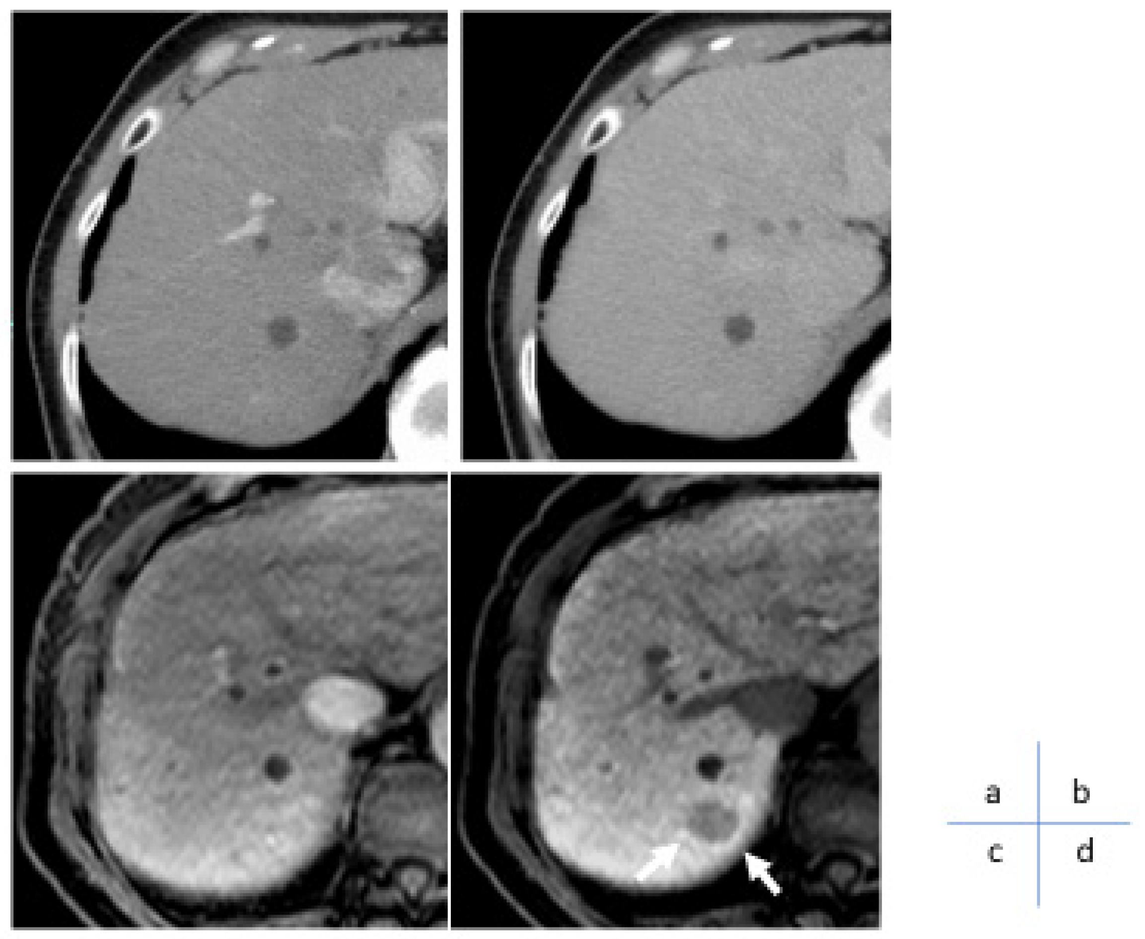 Cancers 17 00101 g004