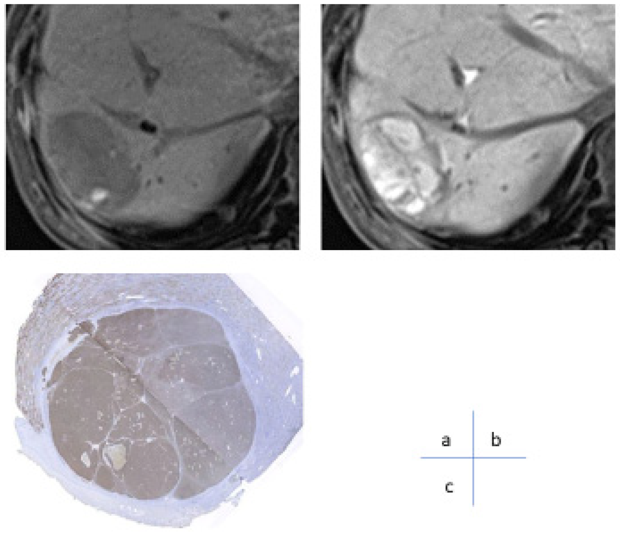 Cancers 17 00101 g007