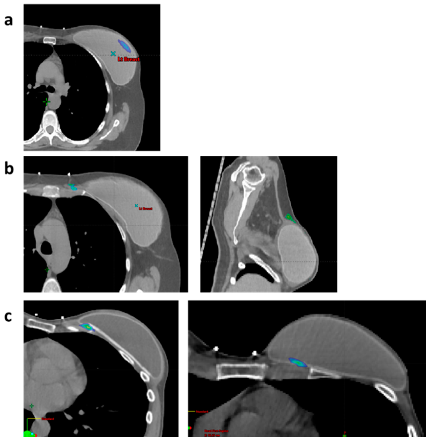 Cancers 17 00106 g003