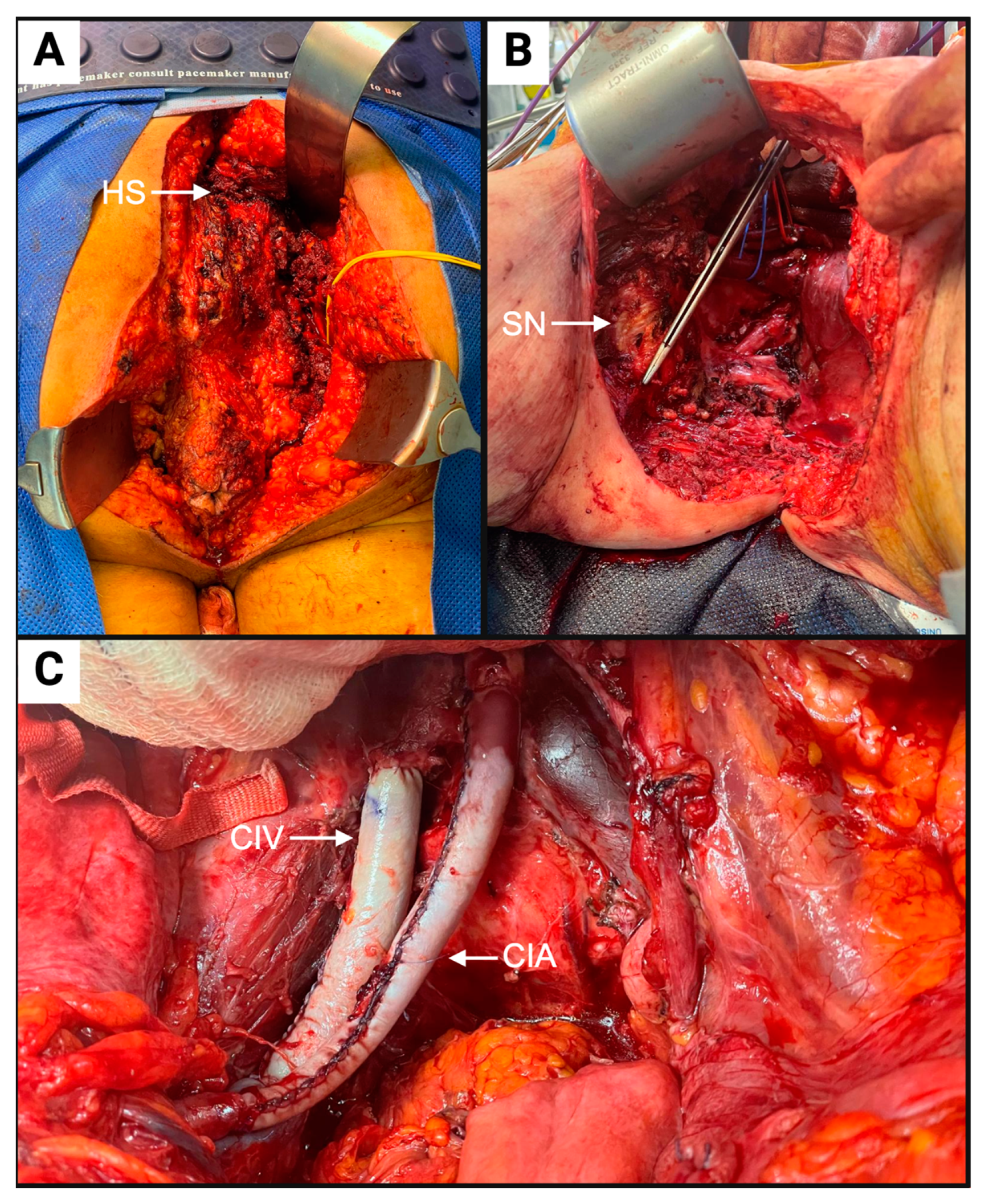 Cancers 17 00111 g001 Cancers 17 00111 g001