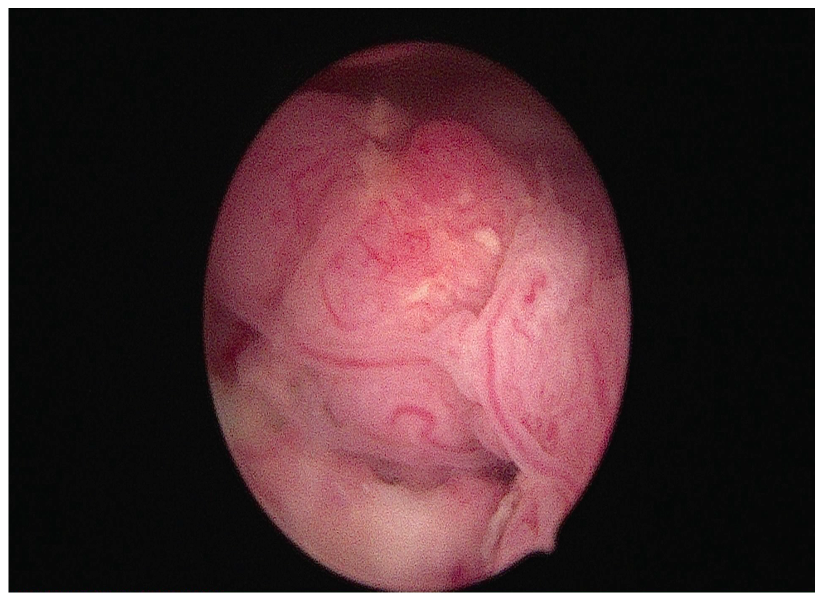 Cancers 17 00112 g003