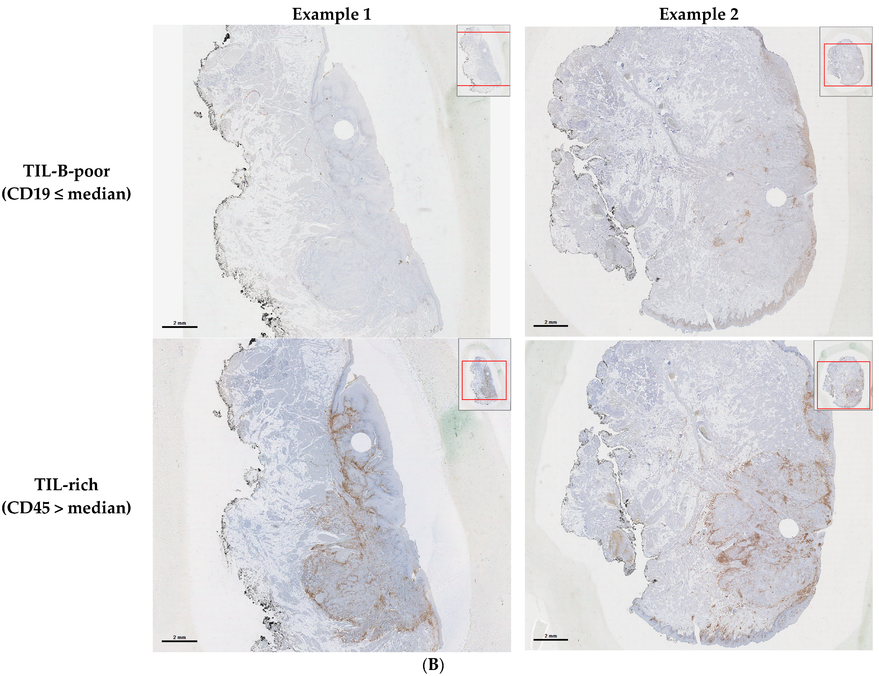 Cancers 17 00113 g001b