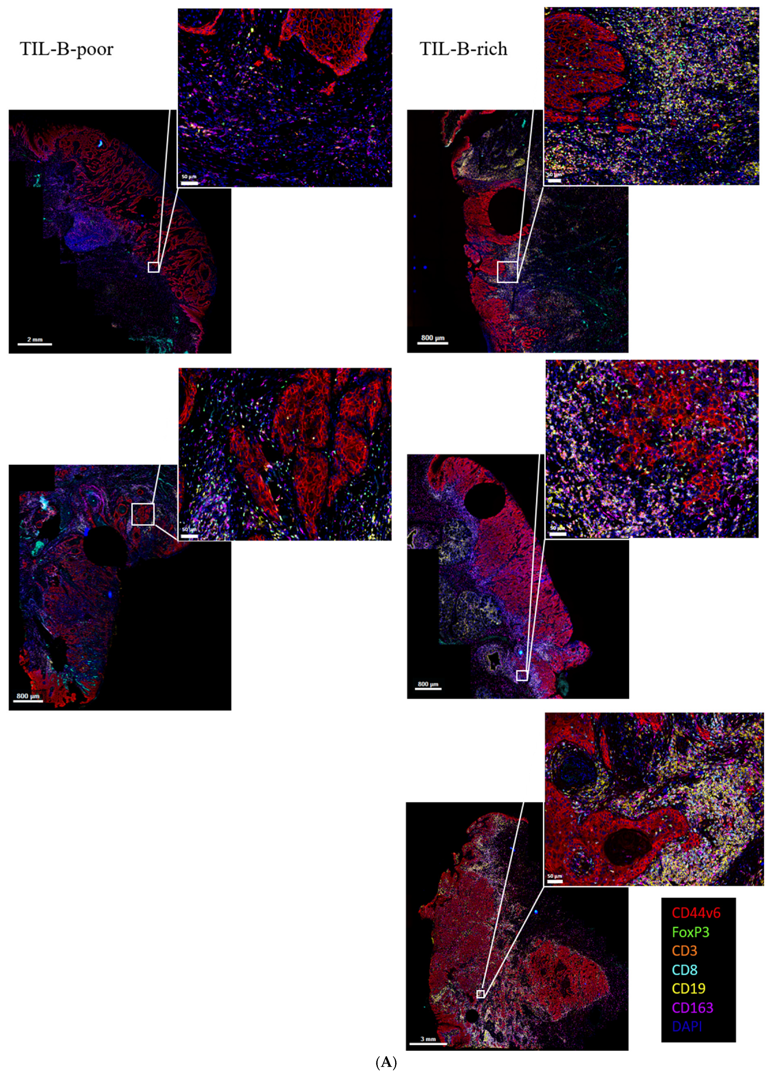 Cancers 17 00113 g006a