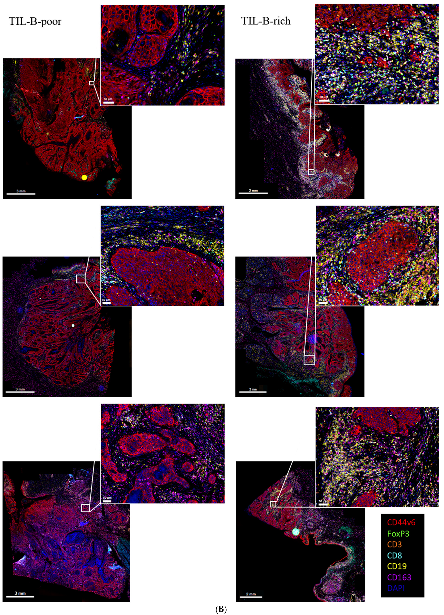 Cancers 17 00113 g006b