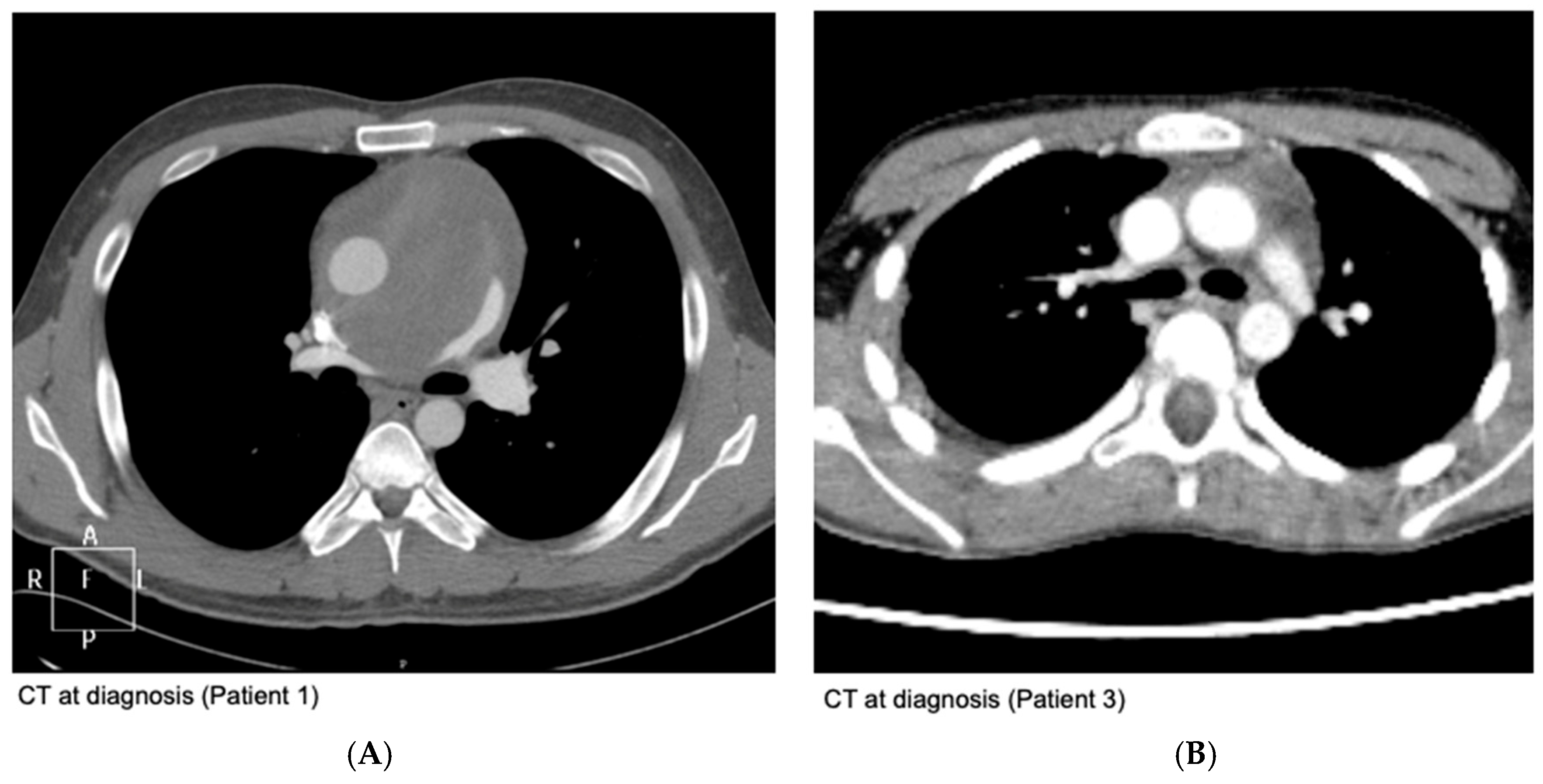 Cancers 17 00118 g001 Cancers 17 00118 g001