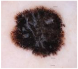 Cancers 17 00137 i004