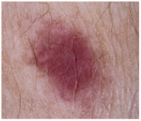 Cancers 17 00137 i005