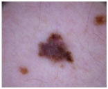 Cancers 17 00137 i009