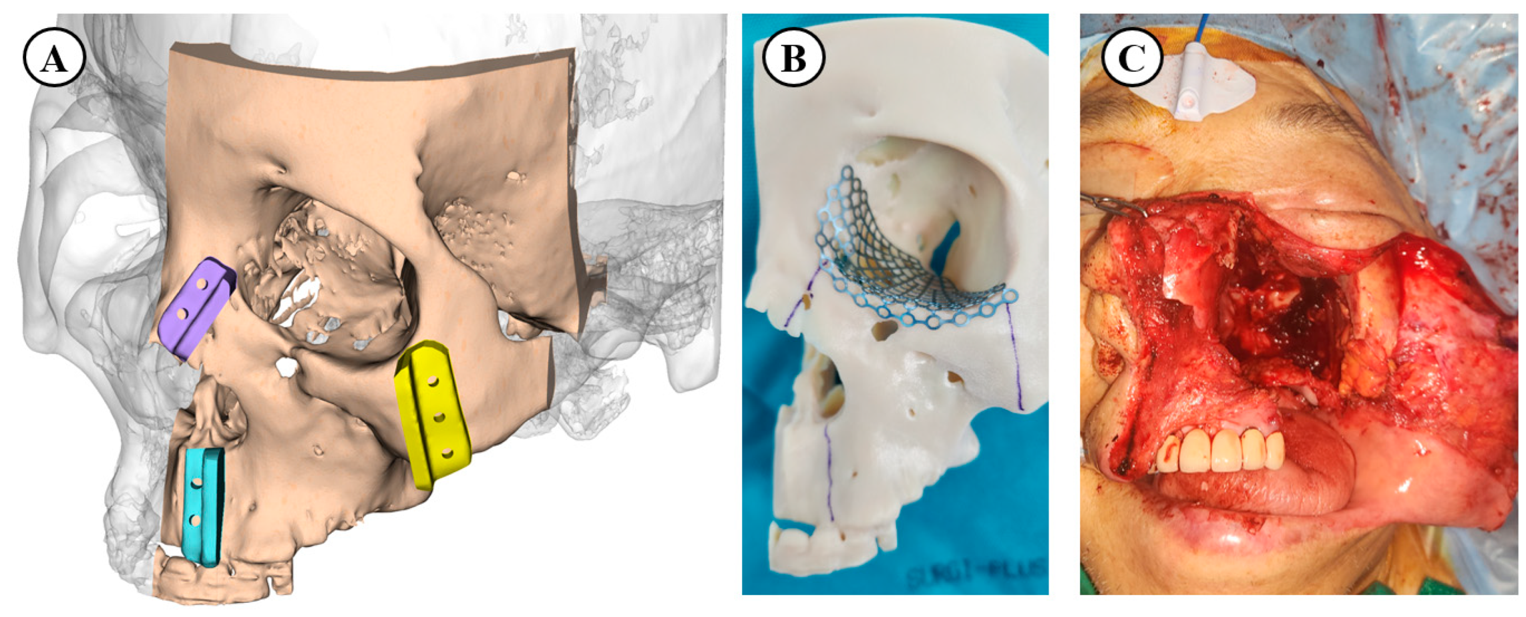 Cancers 17 00140 g001