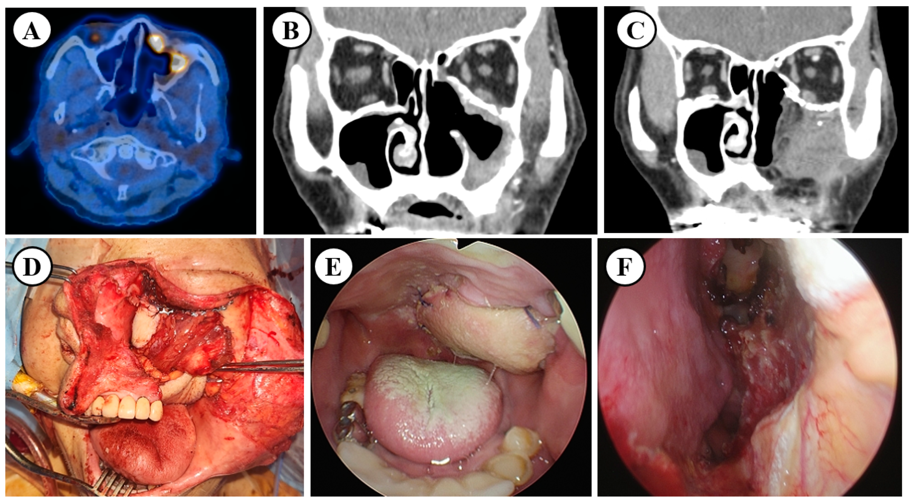 Cancers 17 00140 g002