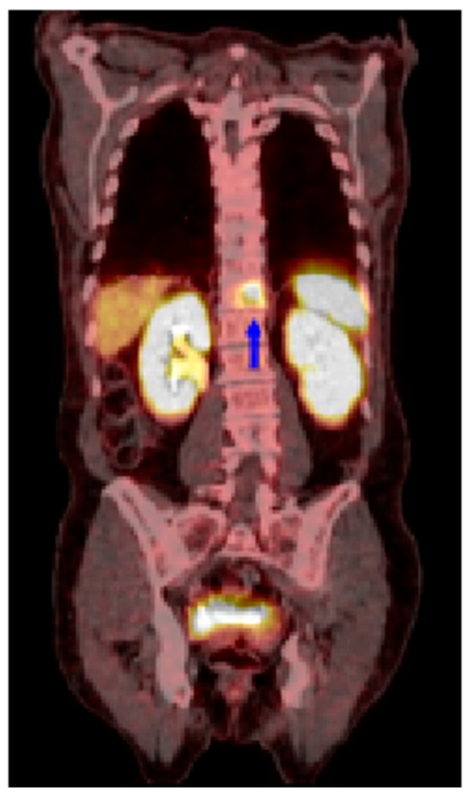 Cancers 17 00162 g005 Cancers 17 00162 g005