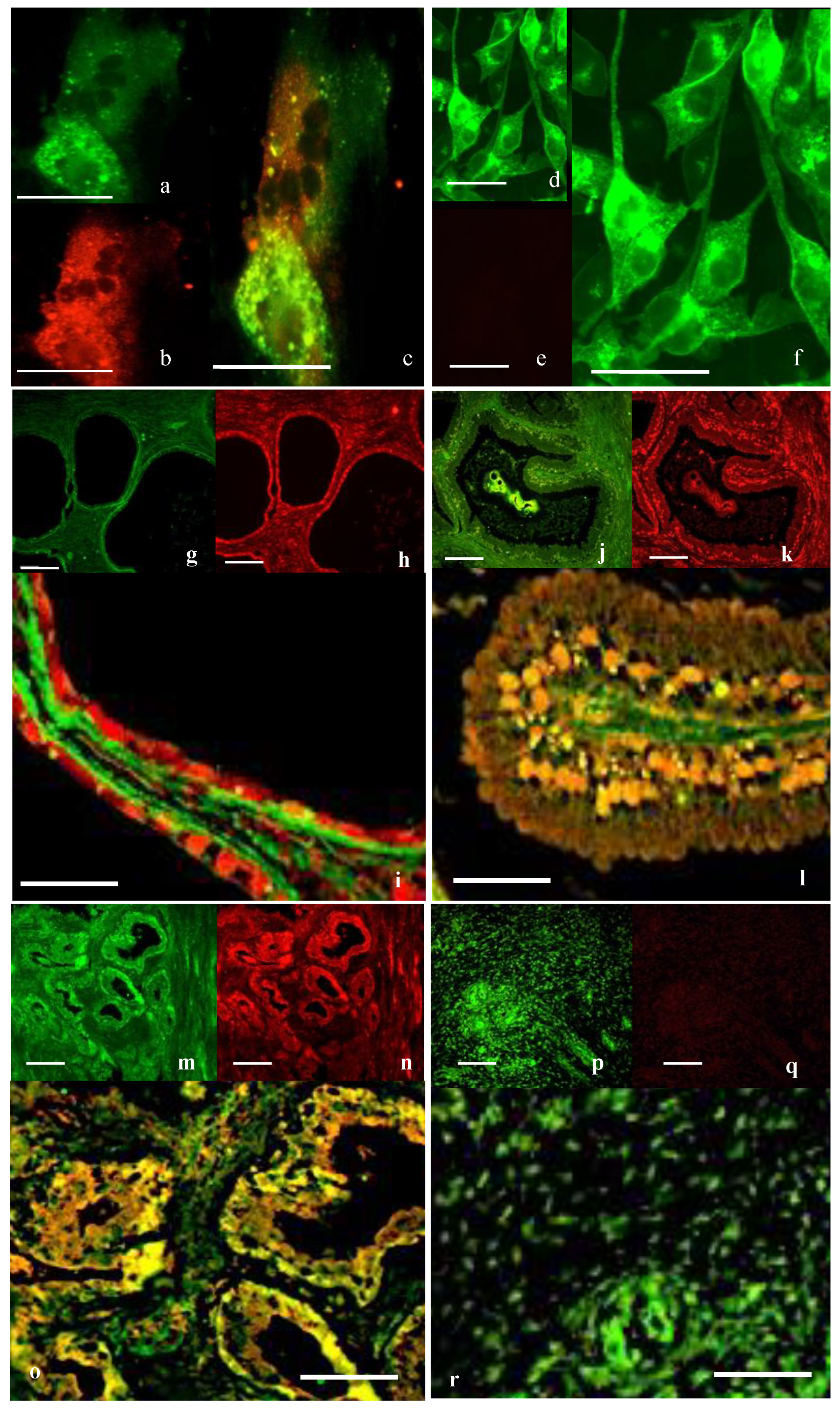 Cancers 17 00182 g001