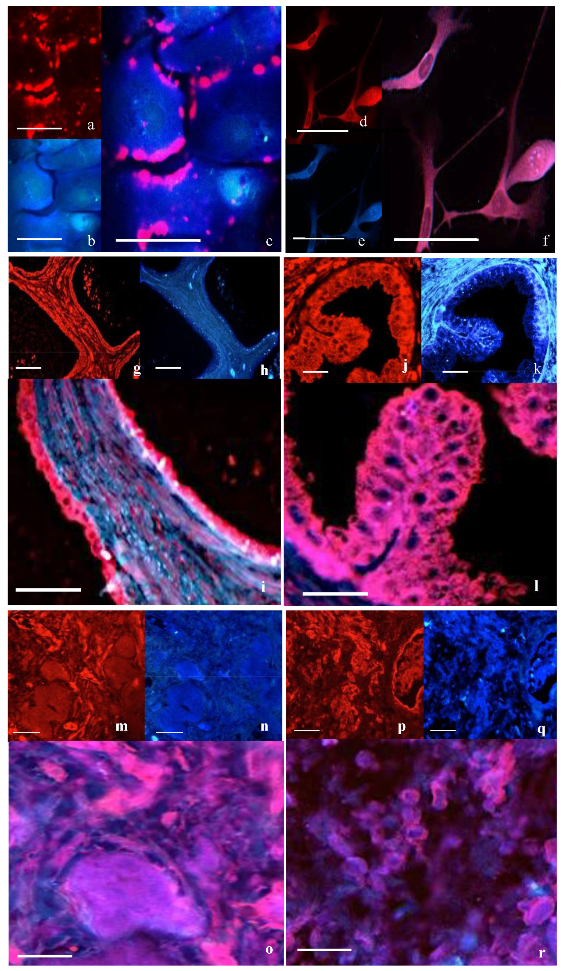 Cancers 17 00182 g002