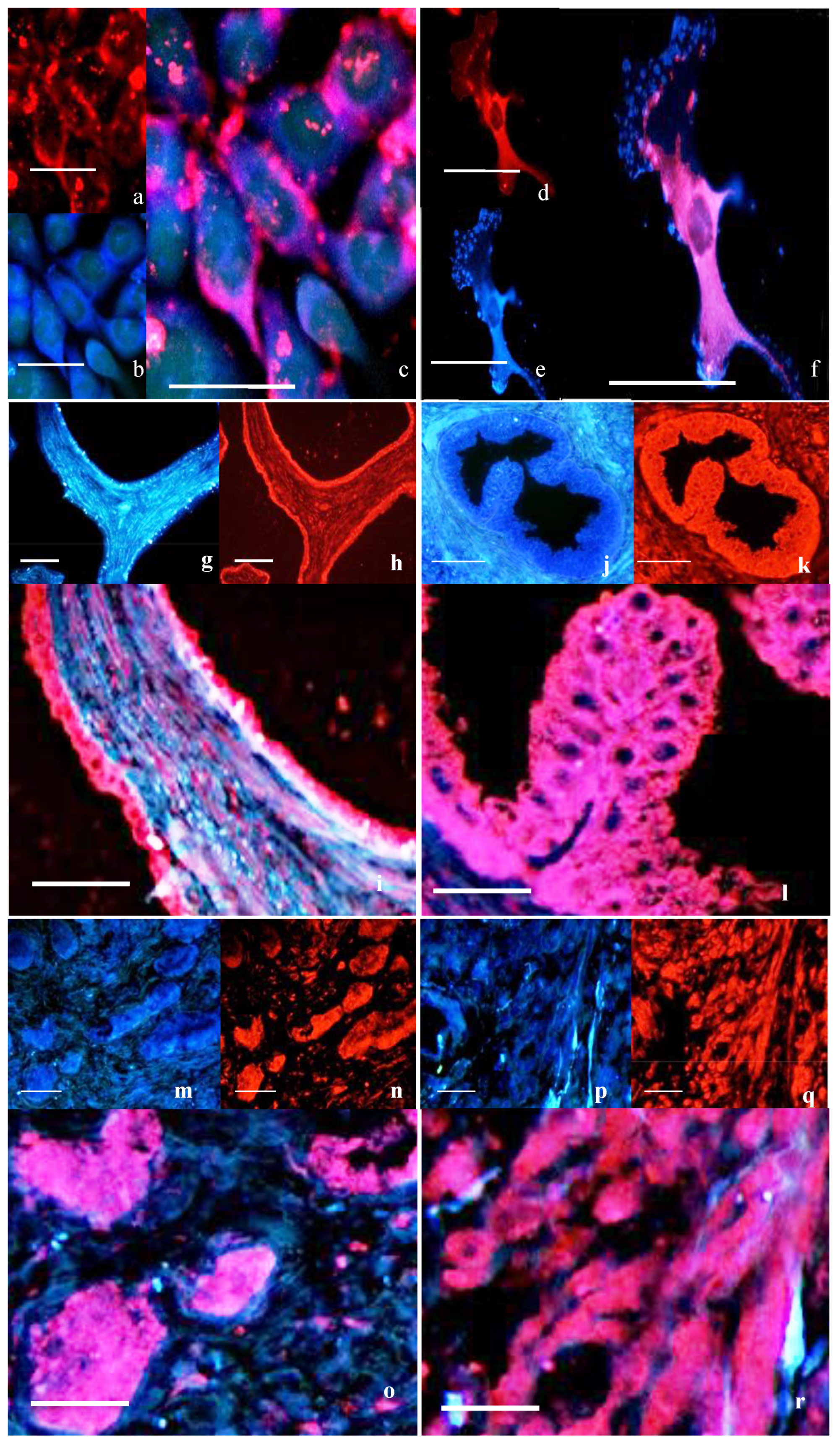 Cancers 17 00182 g003