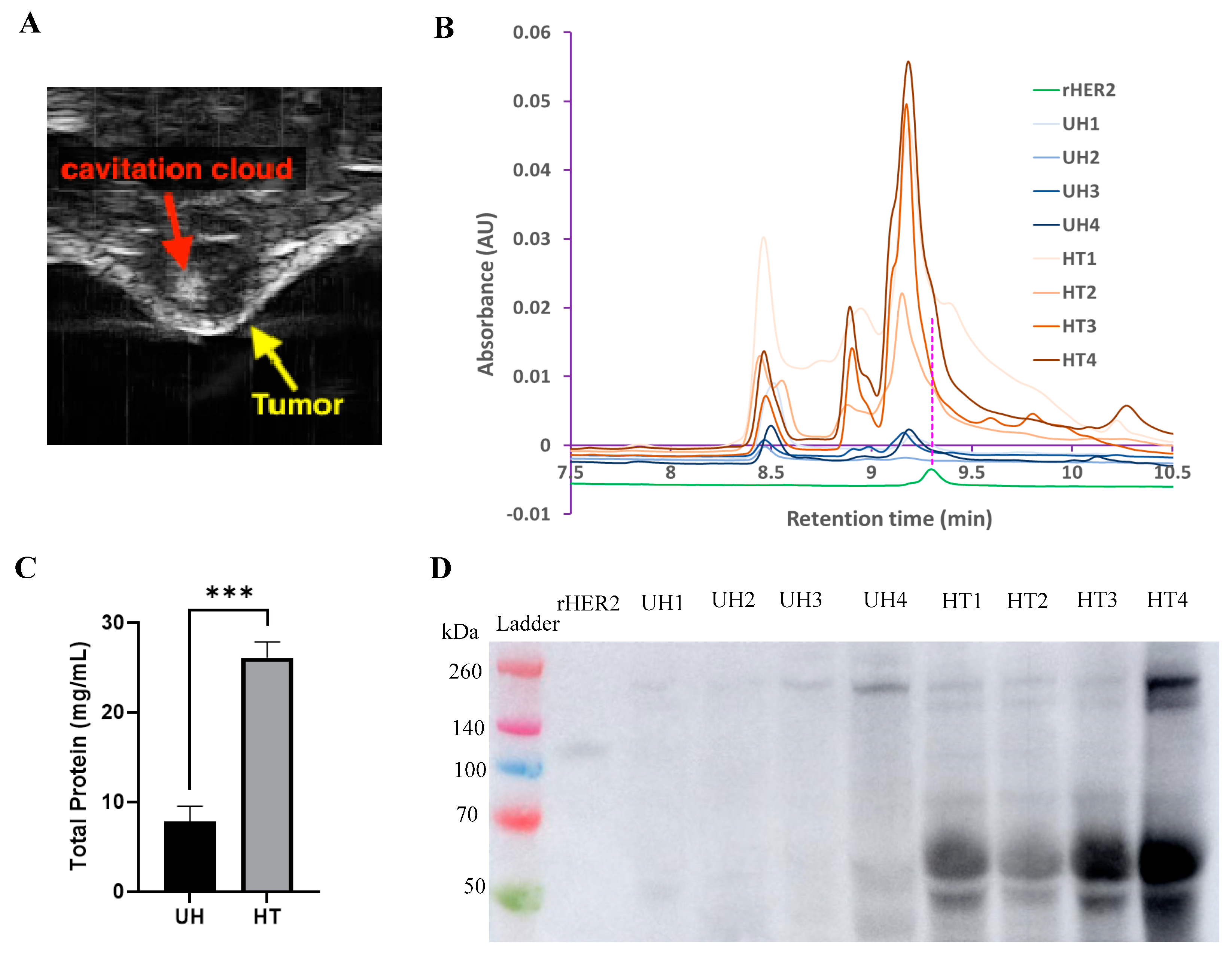 Cancers 17 00183 g011