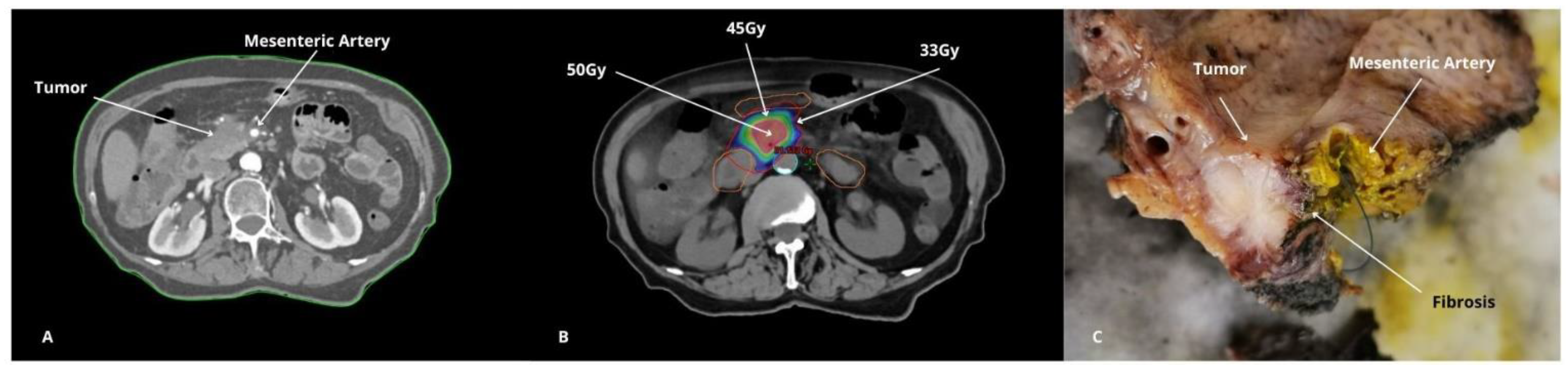 Cancers 17 00191 g002