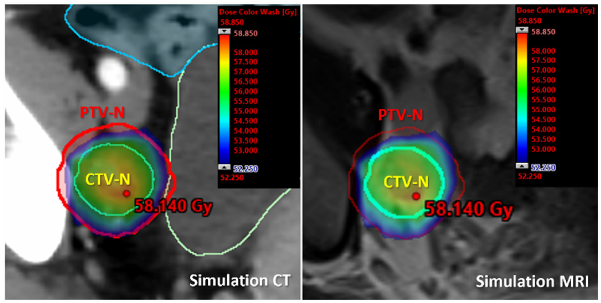 Cancers 17 00202 g001 Cancers 17 00202 g001
