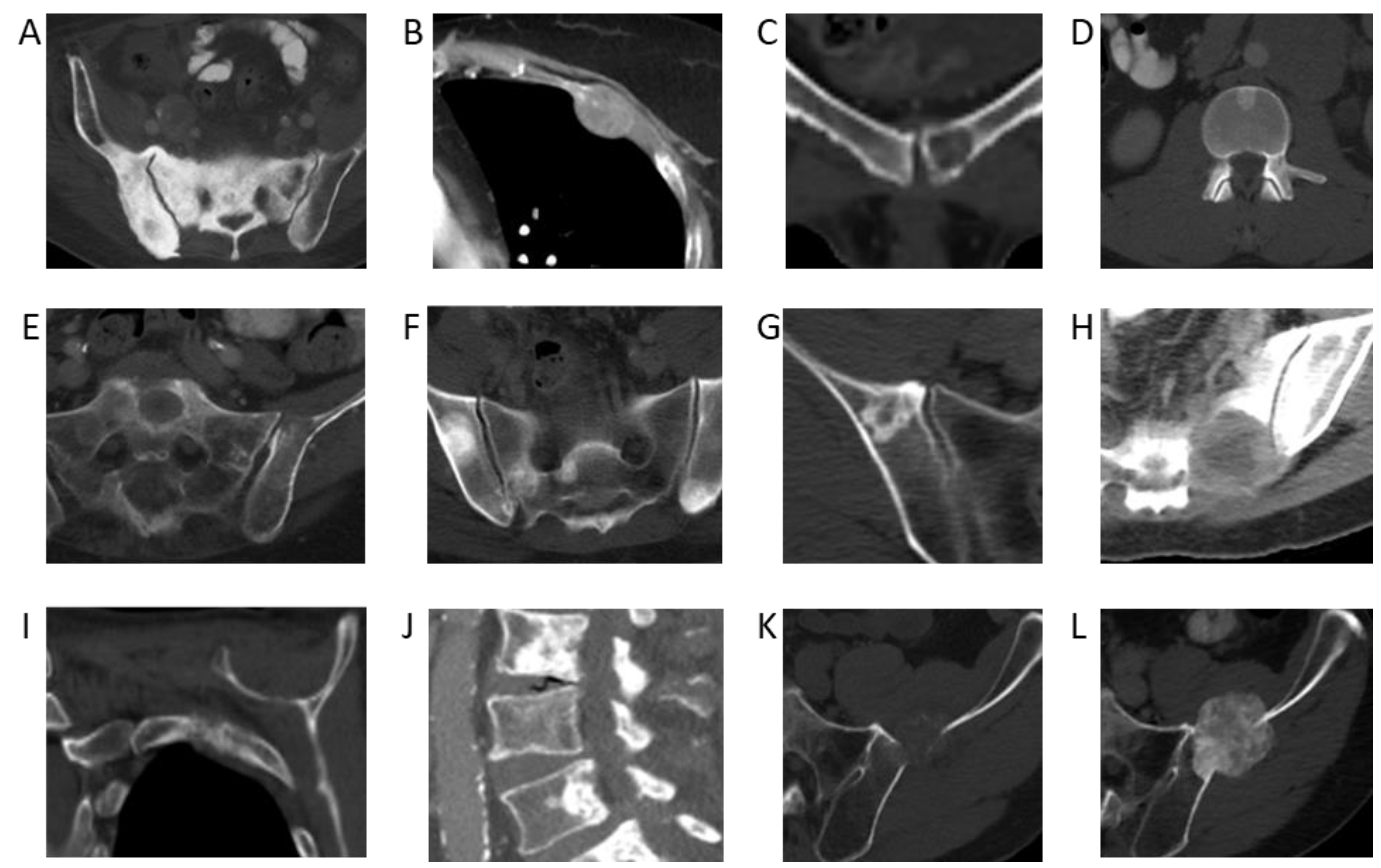 Cancers 17 00218 g002 Cancers 17 00218 g002