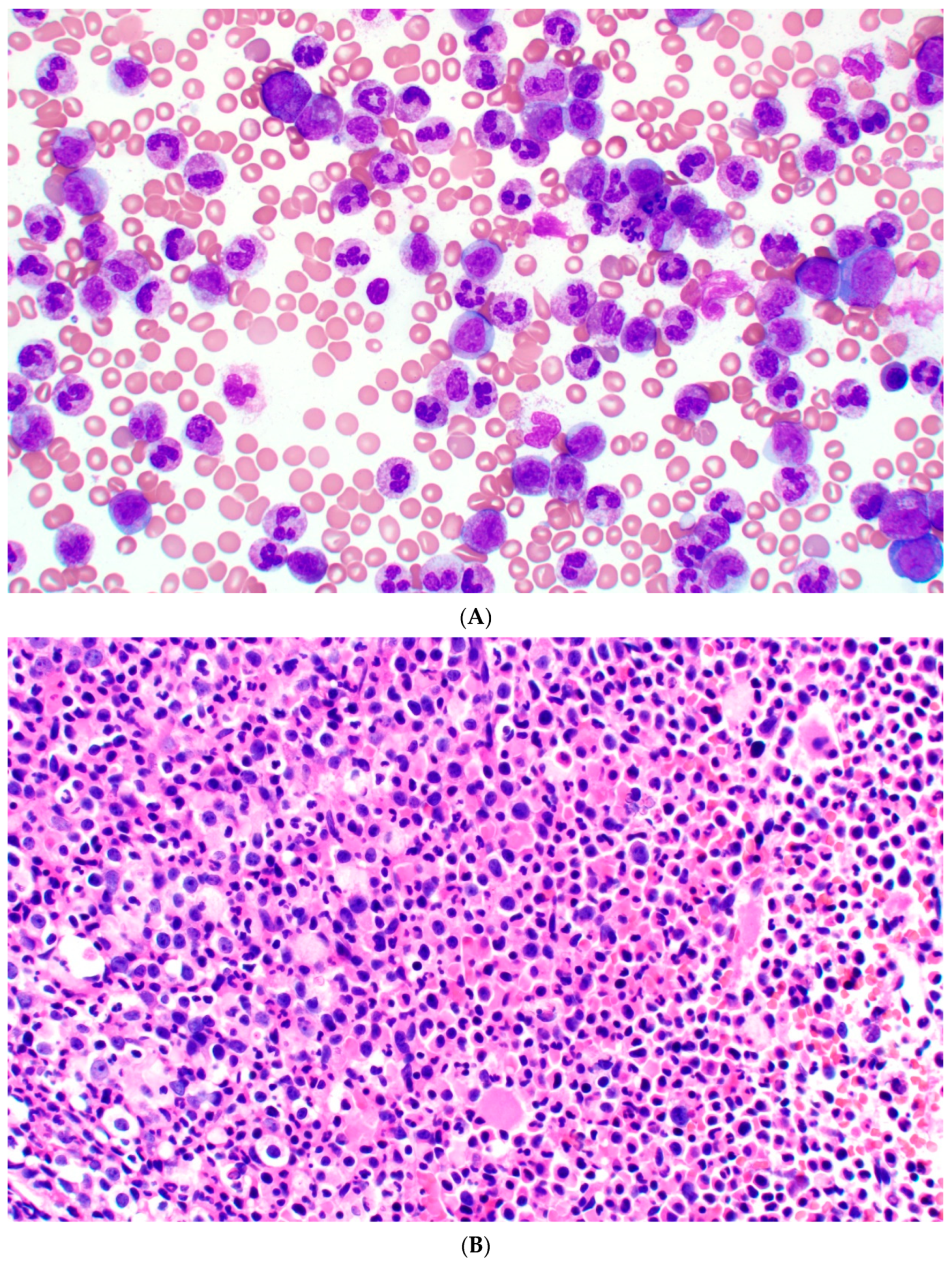 Cancers 17 00227 g001a Cancers 17 00227 g001a