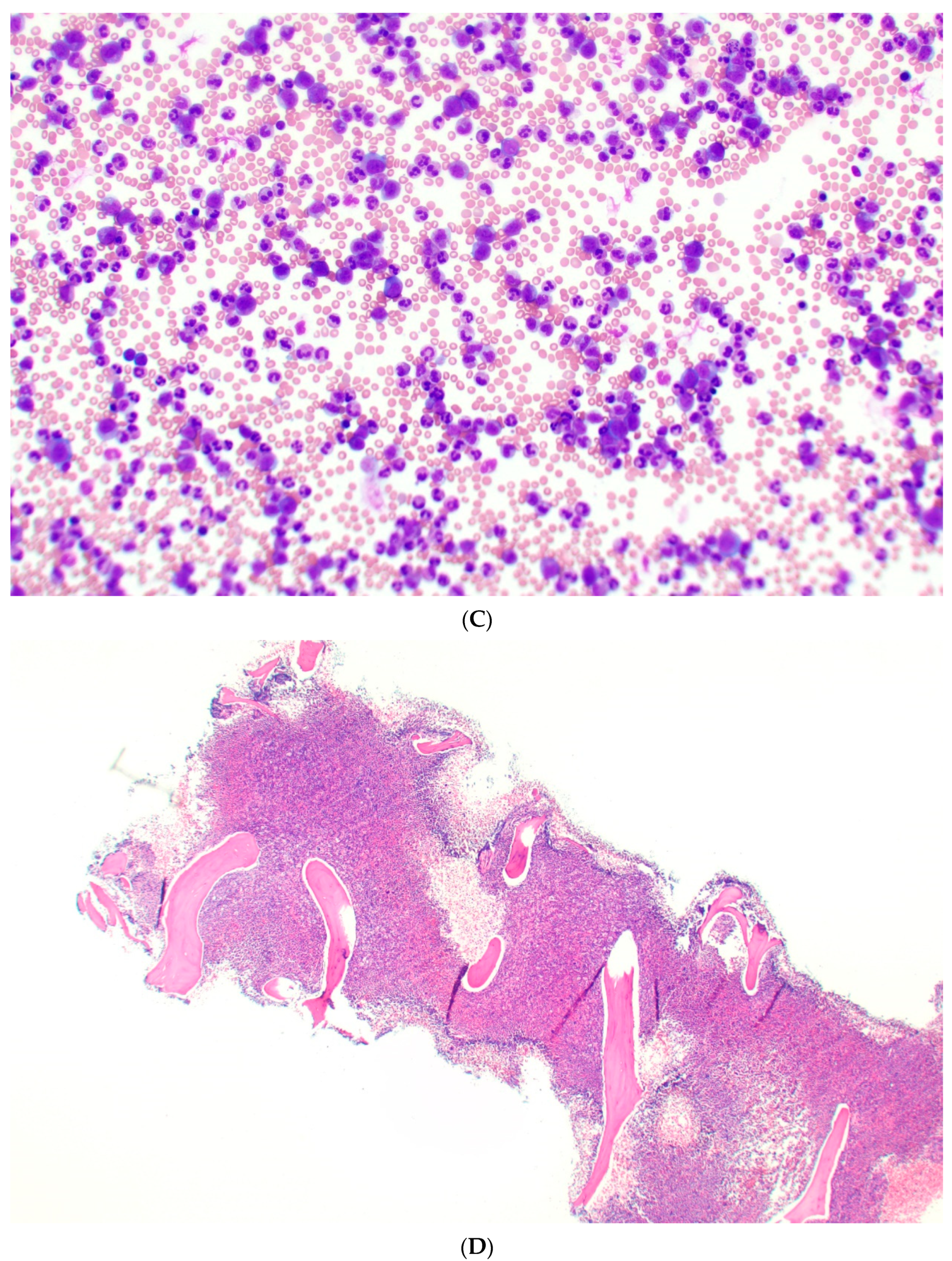 Cancers 17 00227 g001b Cancers 17 00227 g001b