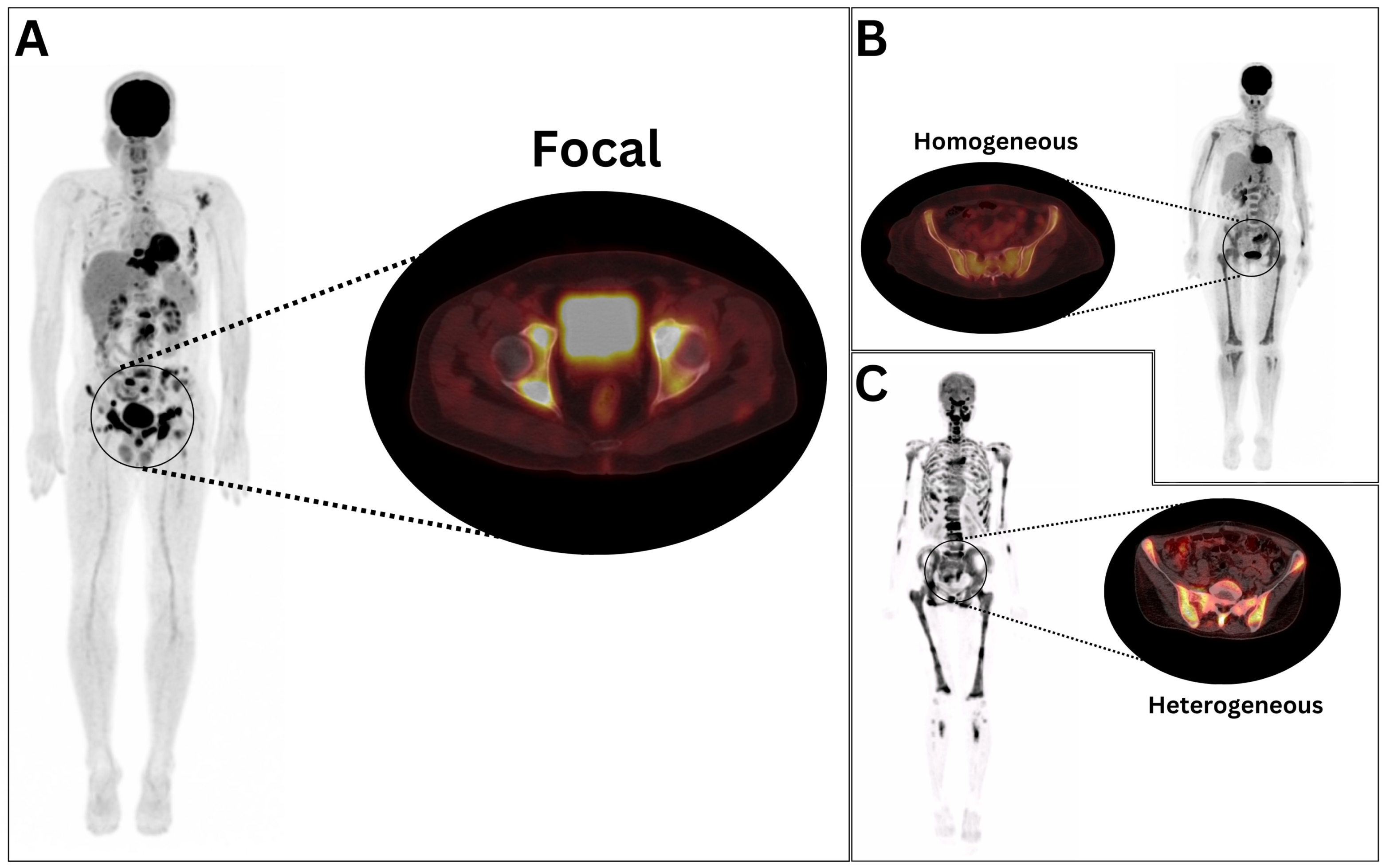 Cancers 17 00231 g001 Cancers 17 00231 g001
