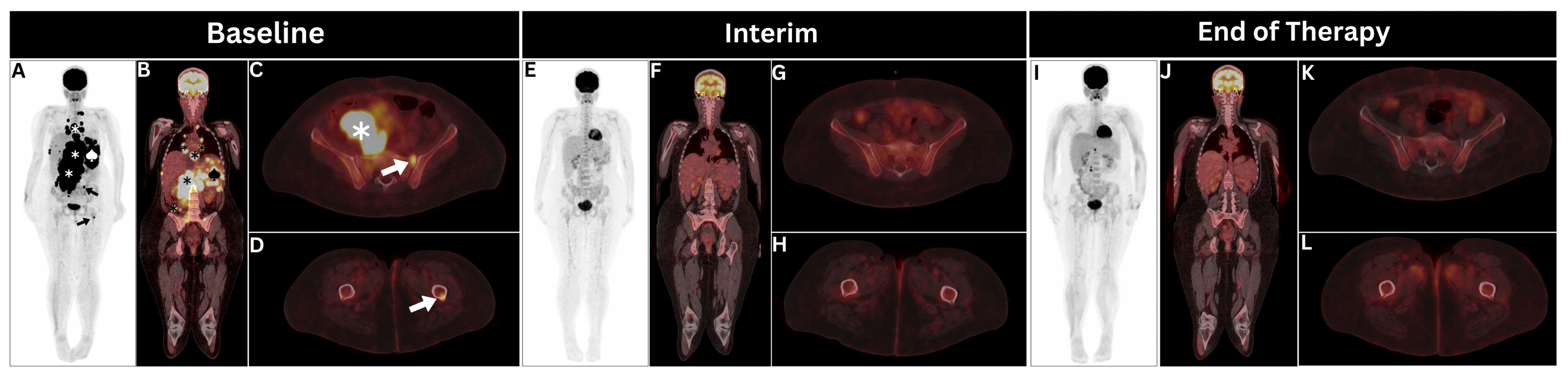 Cancers 17 00231 g002 Cancers 17 00231 g002