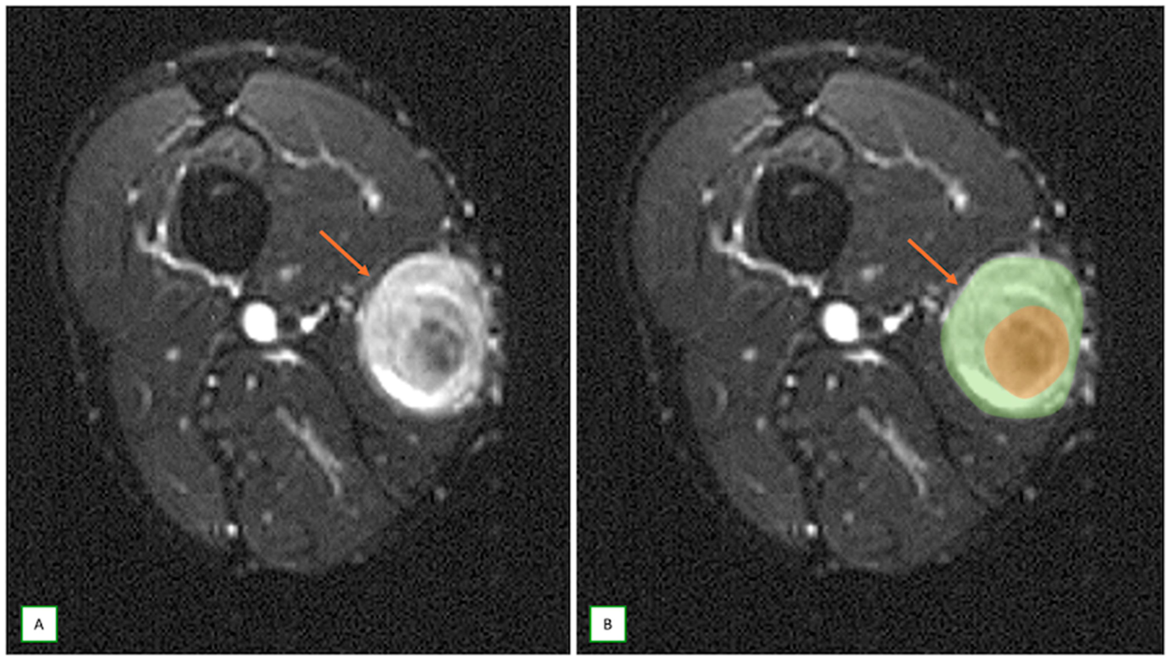 Cancers 17 00246 g004 Cancers 17 00246 g004