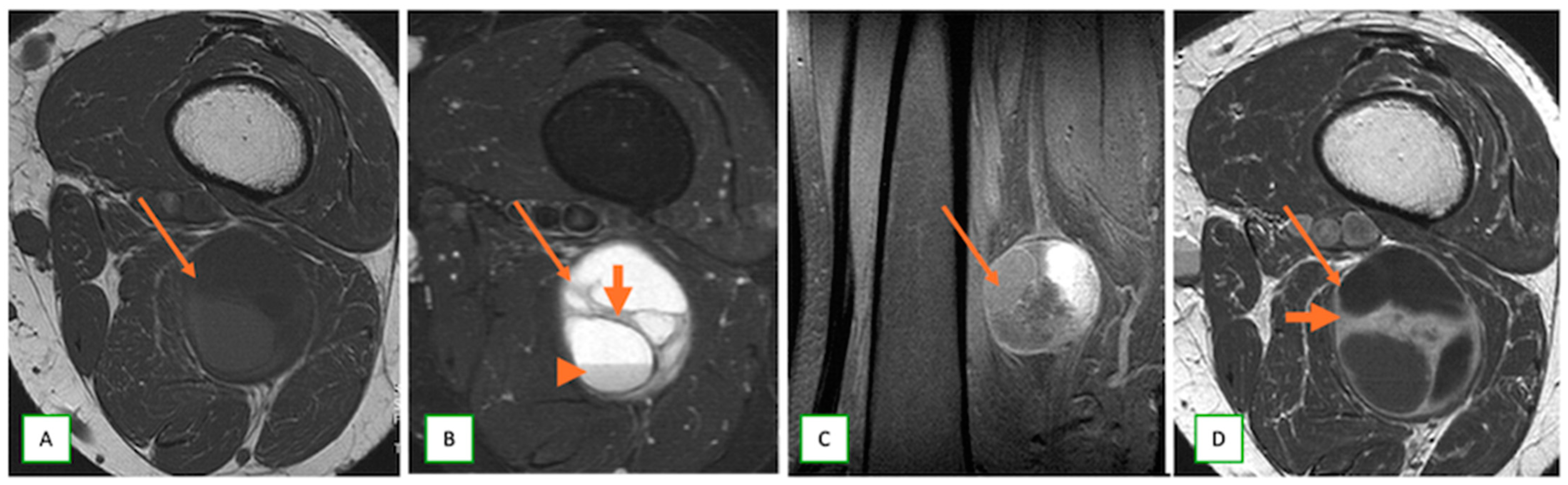 Cancers 17 00246 g008 Cancers 17 00246 g008