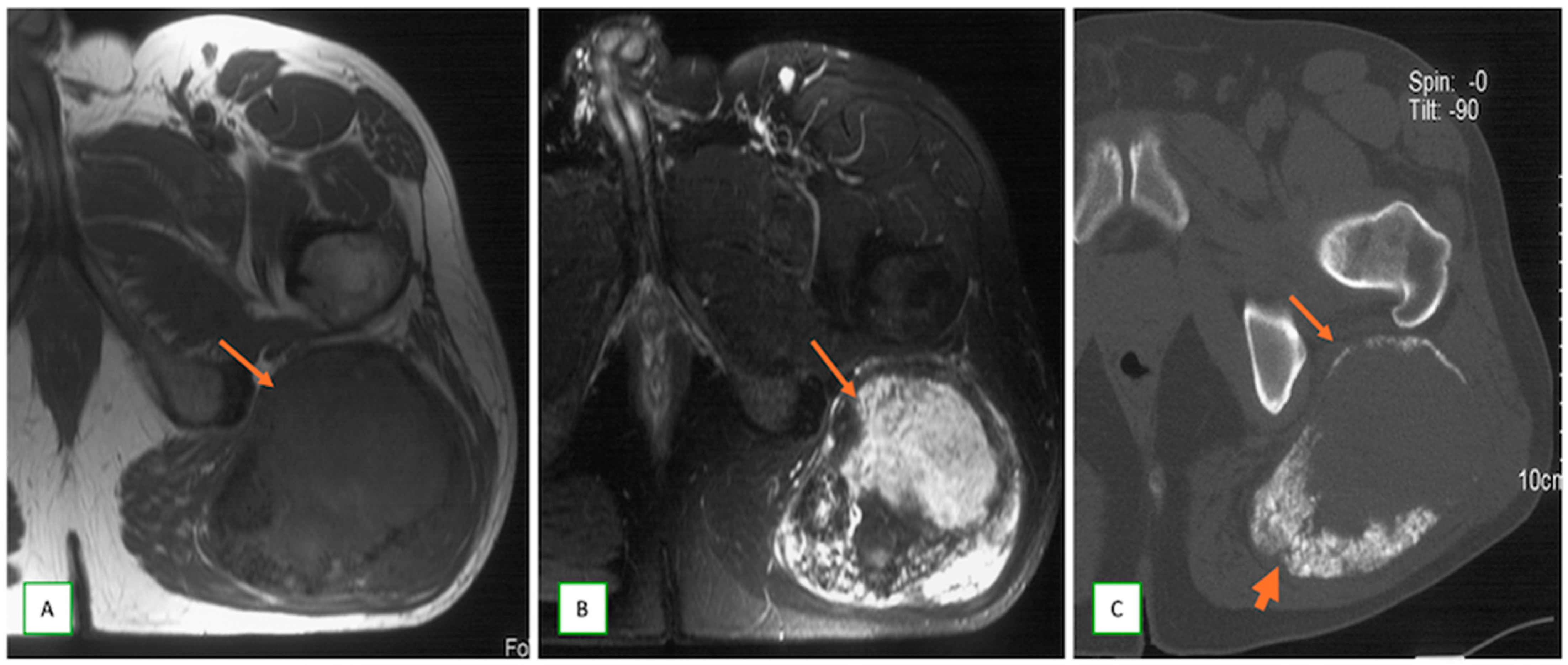 Cancers 17 00246 g009 Cancers 17 00246 g009