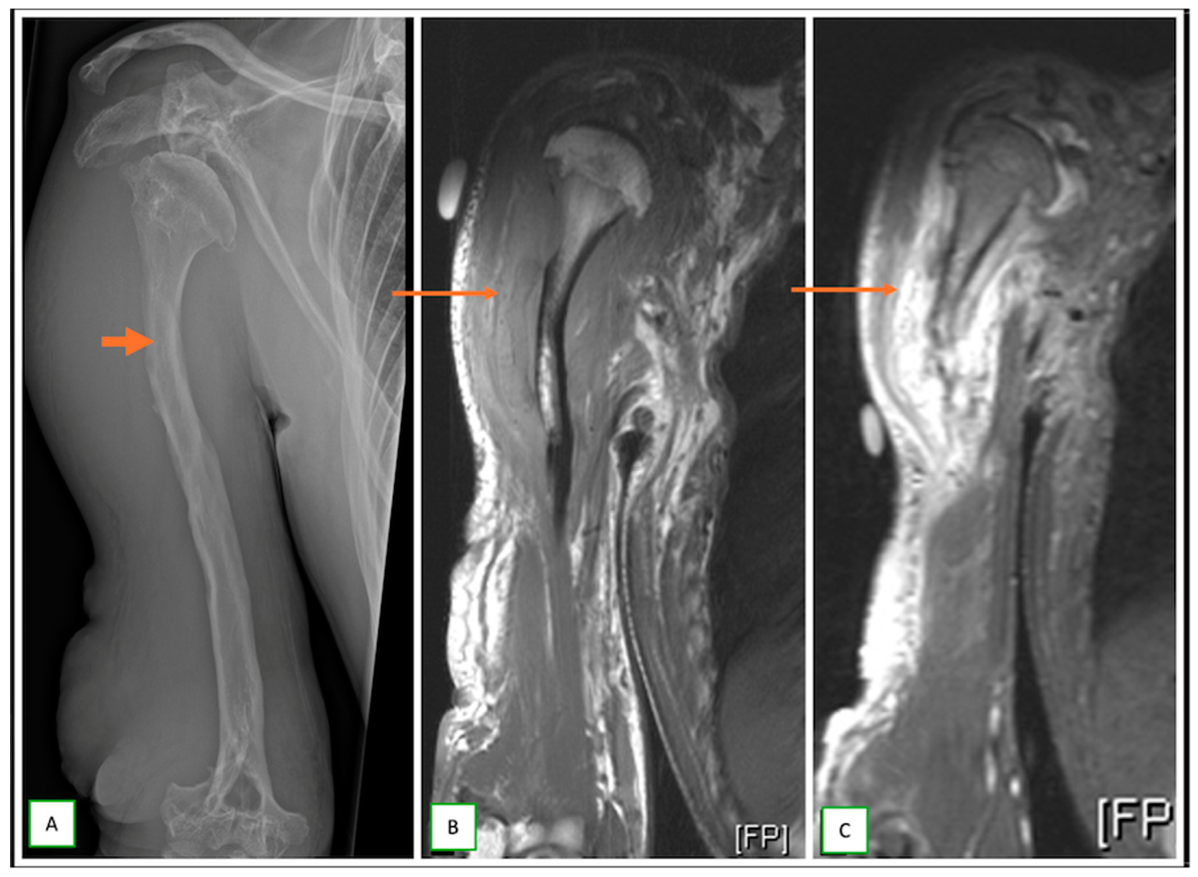 Cancers 17 00246 g011 Cancers 17 00246 g011