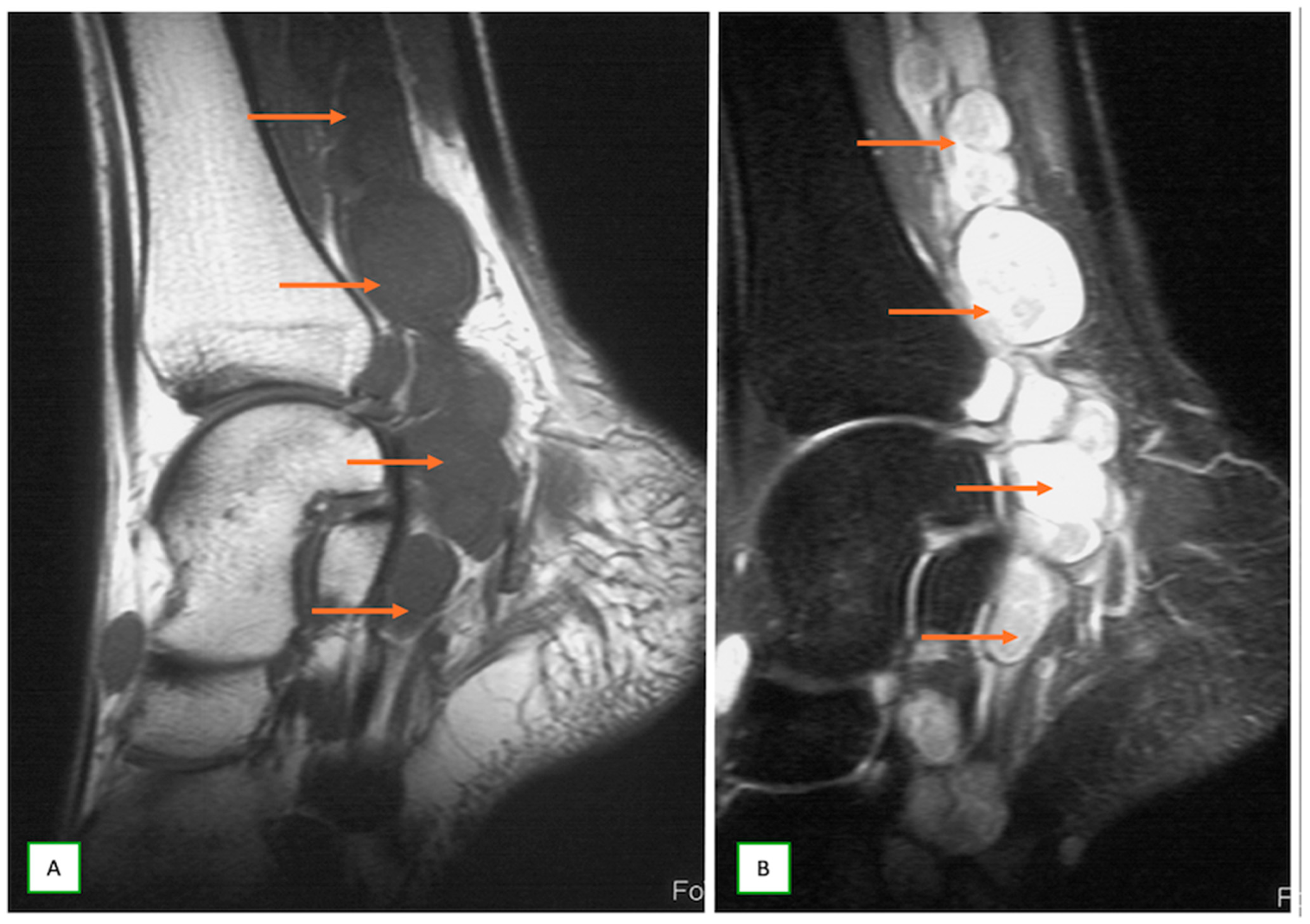 Cancers 17 00246 g012 Cancers 17 00246 g012