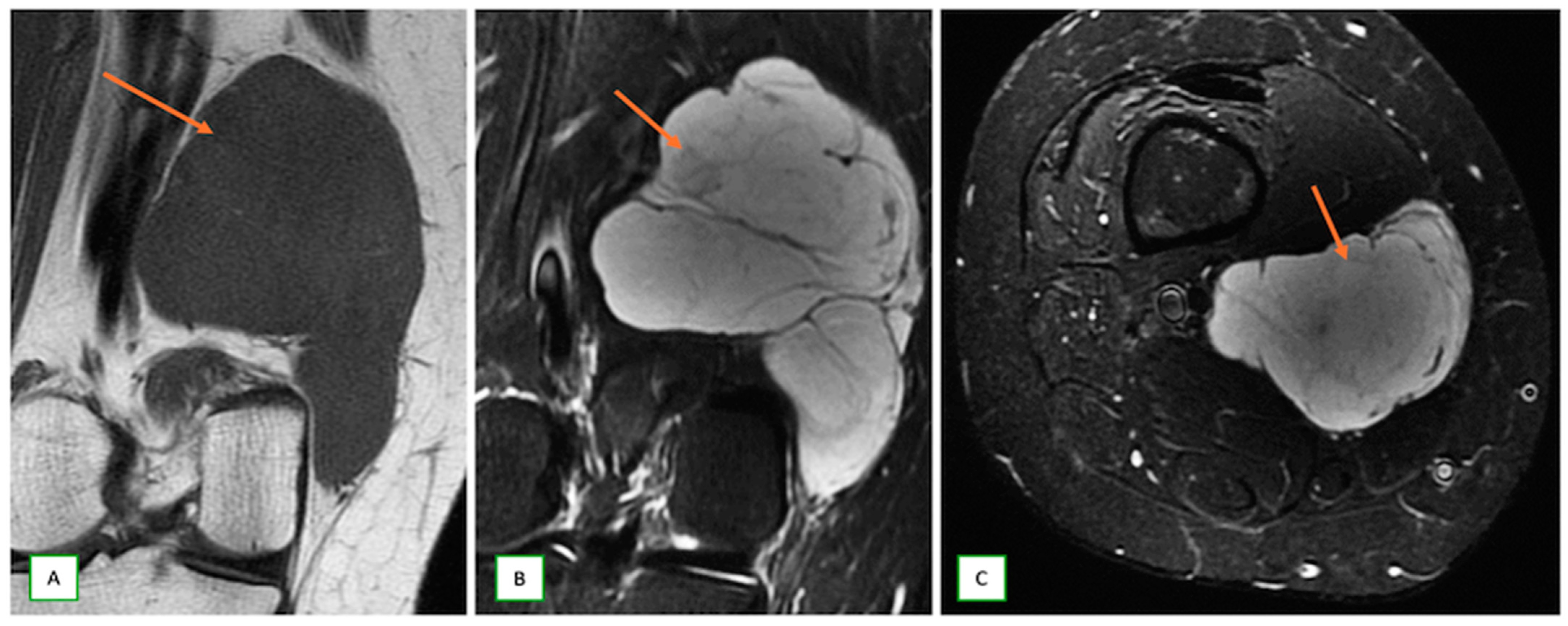 Cancers 17 00246 g014 Cancers 17 00246 g014